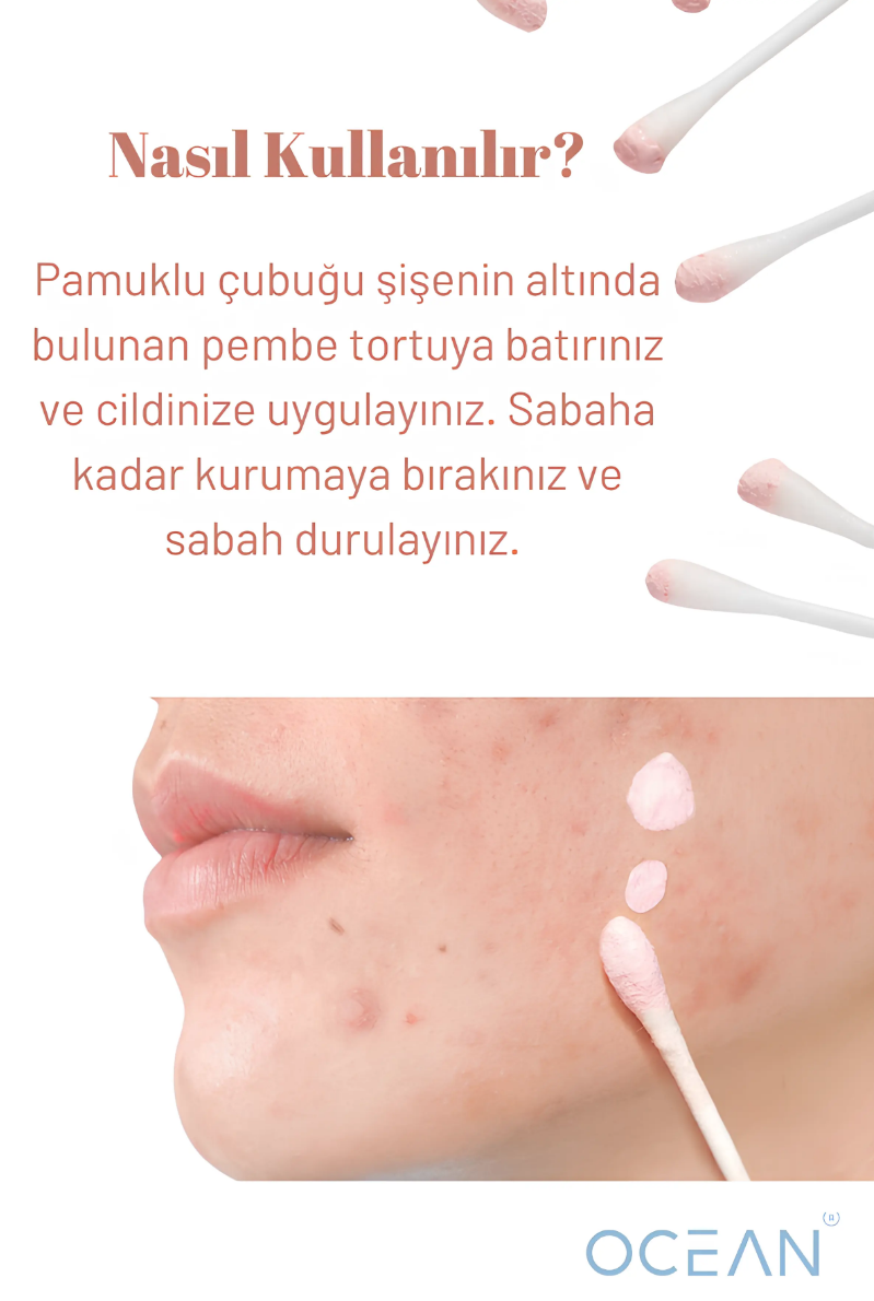 Ocean Akne Kurutucu Losyon - Acne Care 30 MlOcean