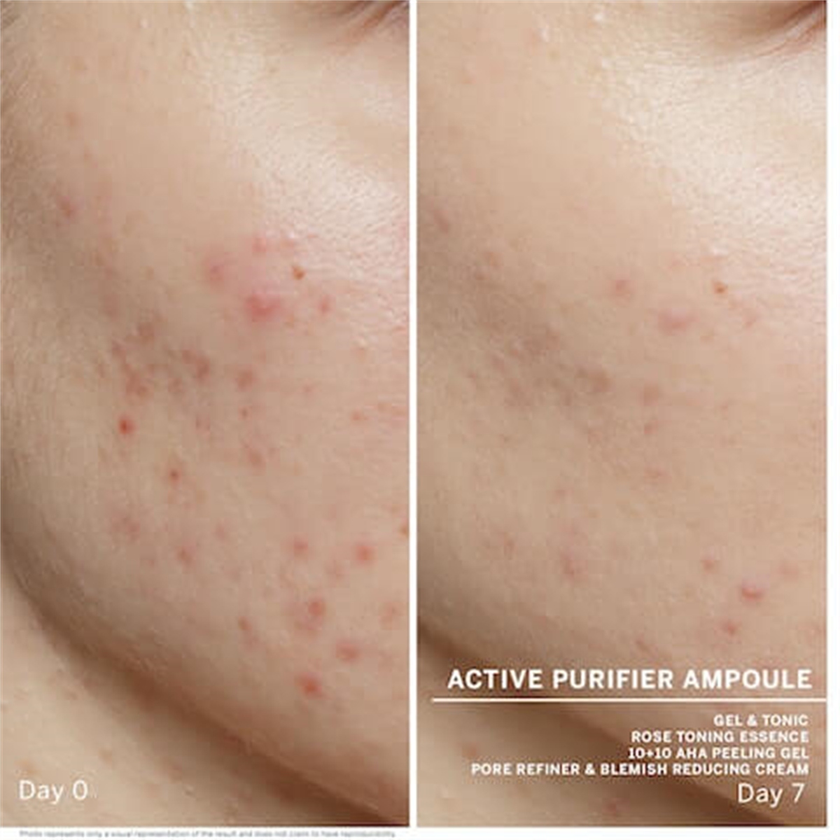 Babor Active Purifier Problemli Ciltler İçin Arındırıcı Ampul Konsantresi 7x2 ml