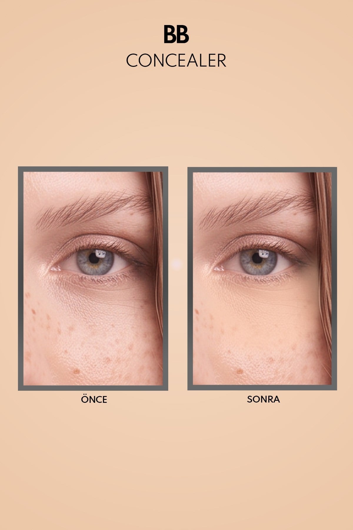 Note BB Concealer 03 SPF 15 Göz Altı Kapatıcısı-30110224