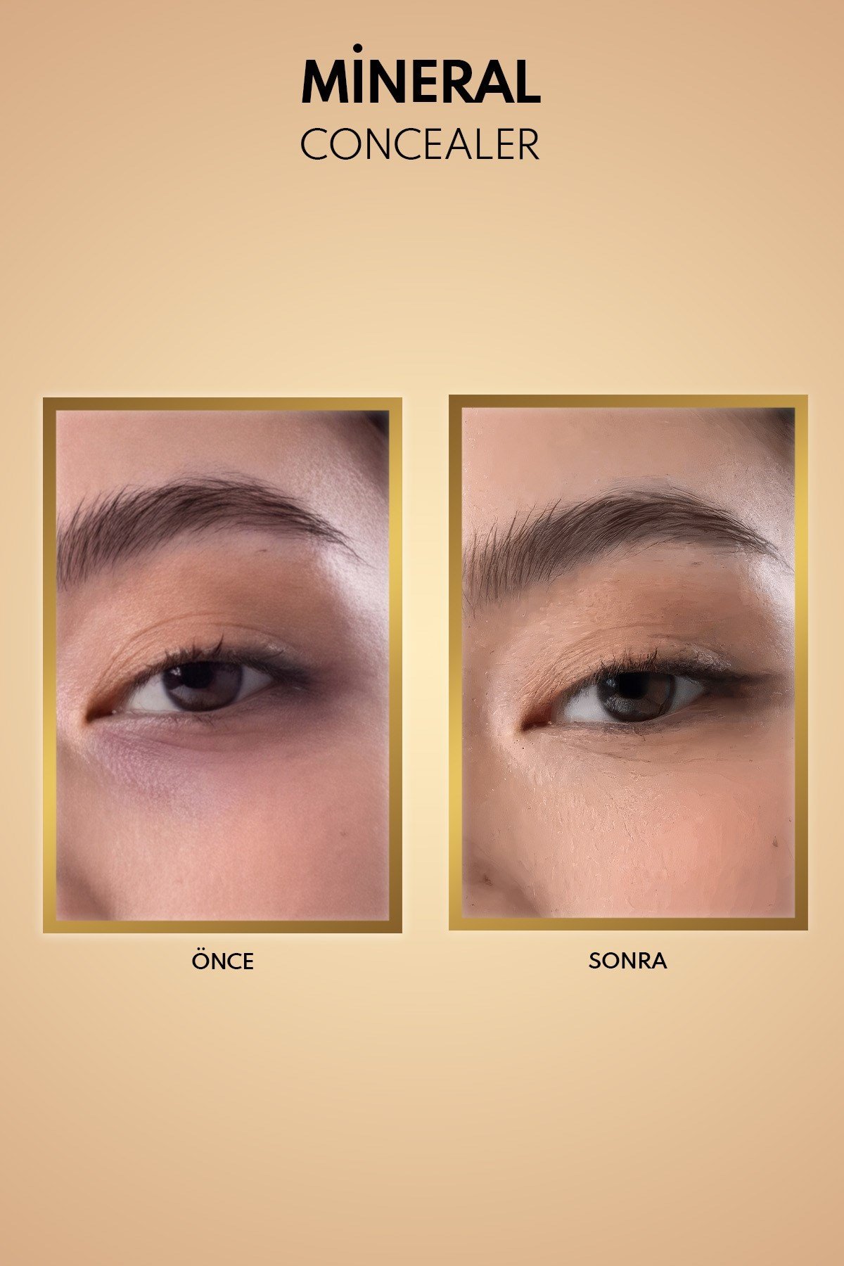 Note Mineral Concealer 201 SPF 15 Göz Altı Kapatıcısı-30110249