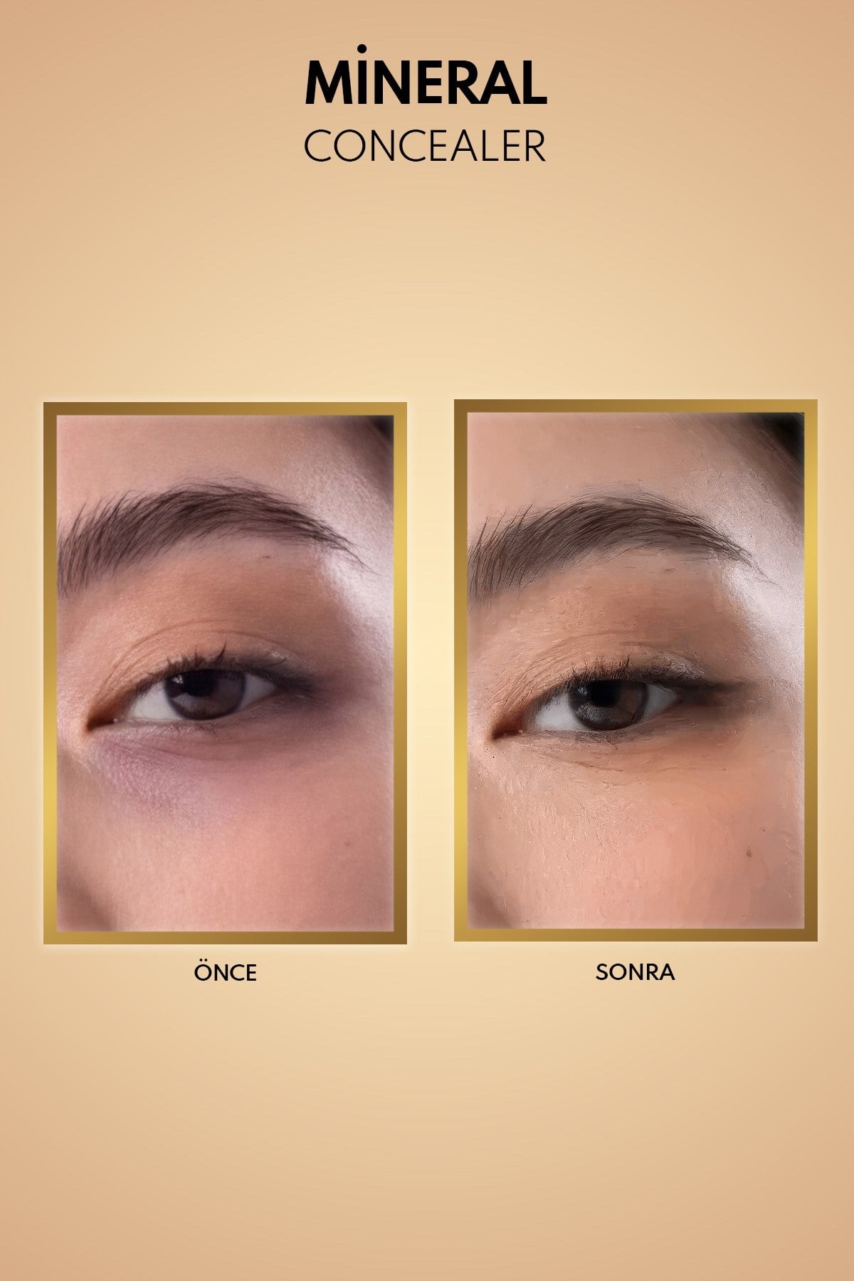 Note Mineral Concealer 202 SPF 15 Göz Altı Kapatıcısı-30110250