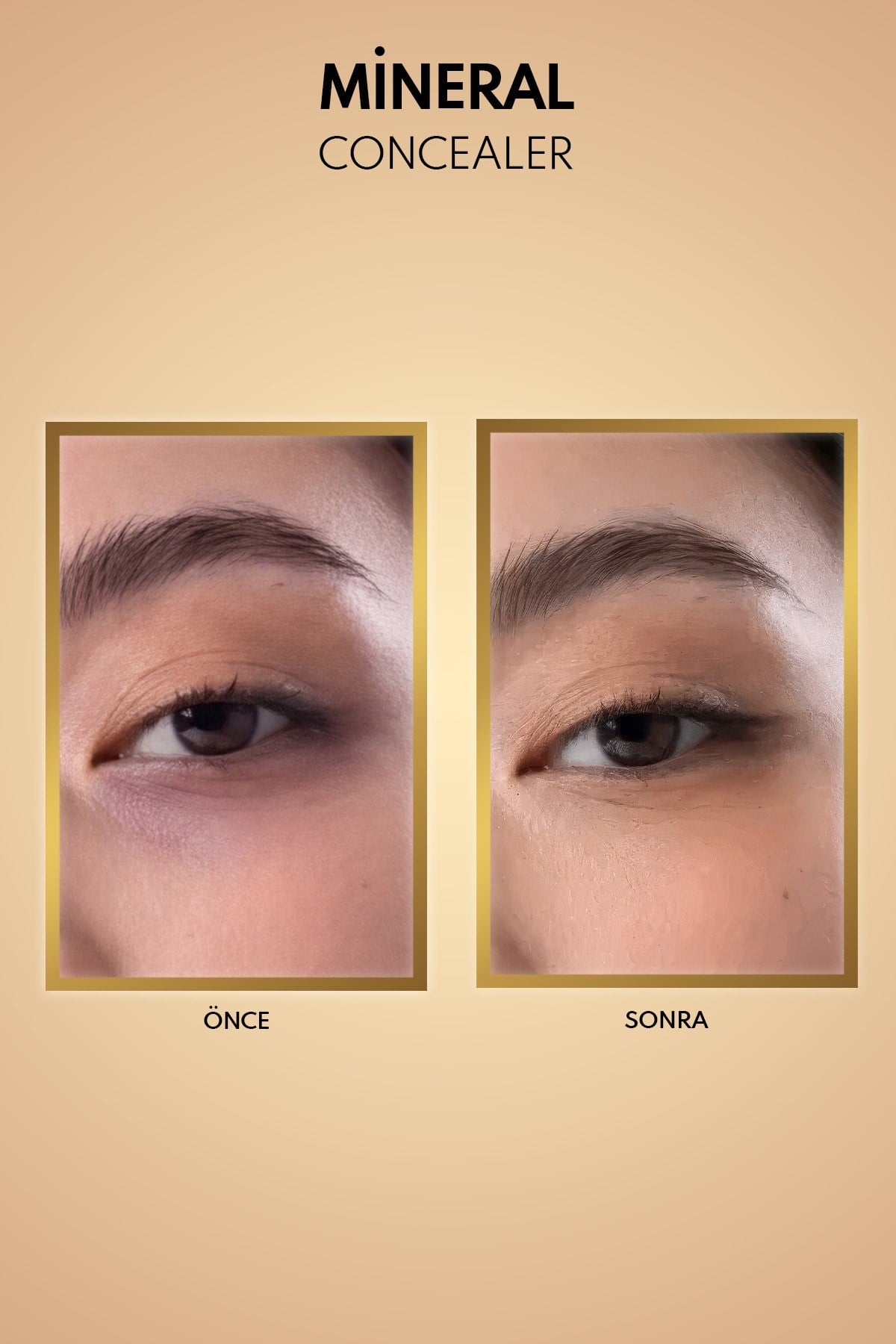Note Mineral Concealer 203 SPF 15 Göz Altı Kapatıcısı-30110251