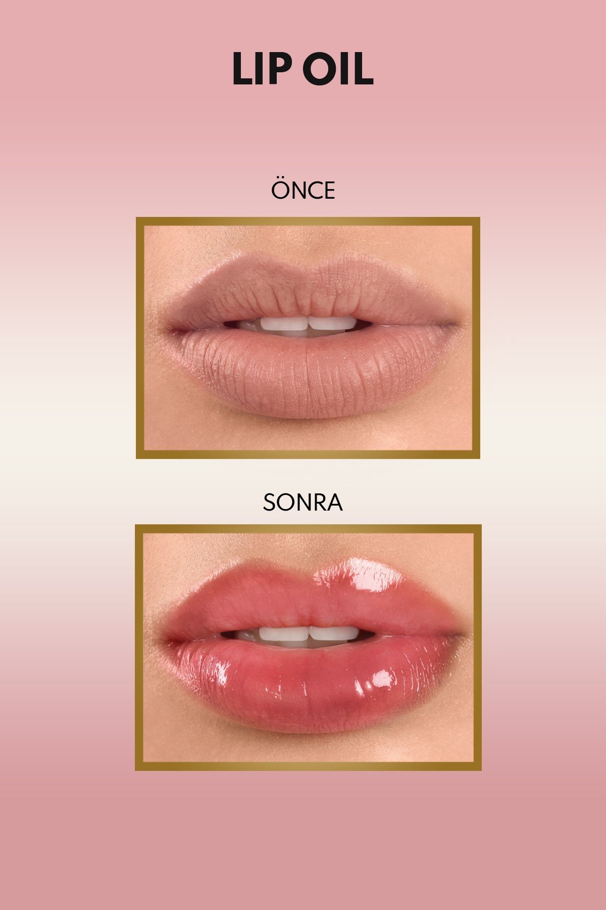 Note Lip Oil 40 Sugar Red Nemlendirici ve Parlatıcı Dudak Bakım Yağı - Kırmızı-30111423