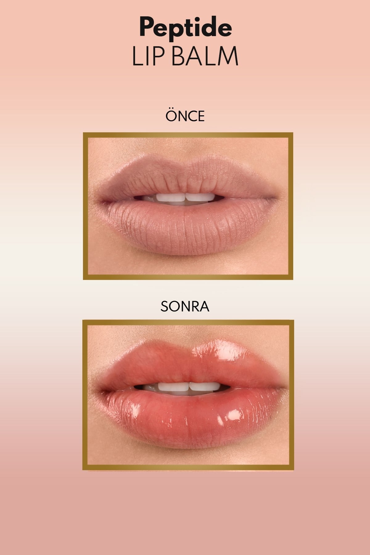 Note Peptide Lip Balm 02 Fun Day SPF 30 Nemlendirici ve Parlatıcı Renkli Dudak Balmı-30111481