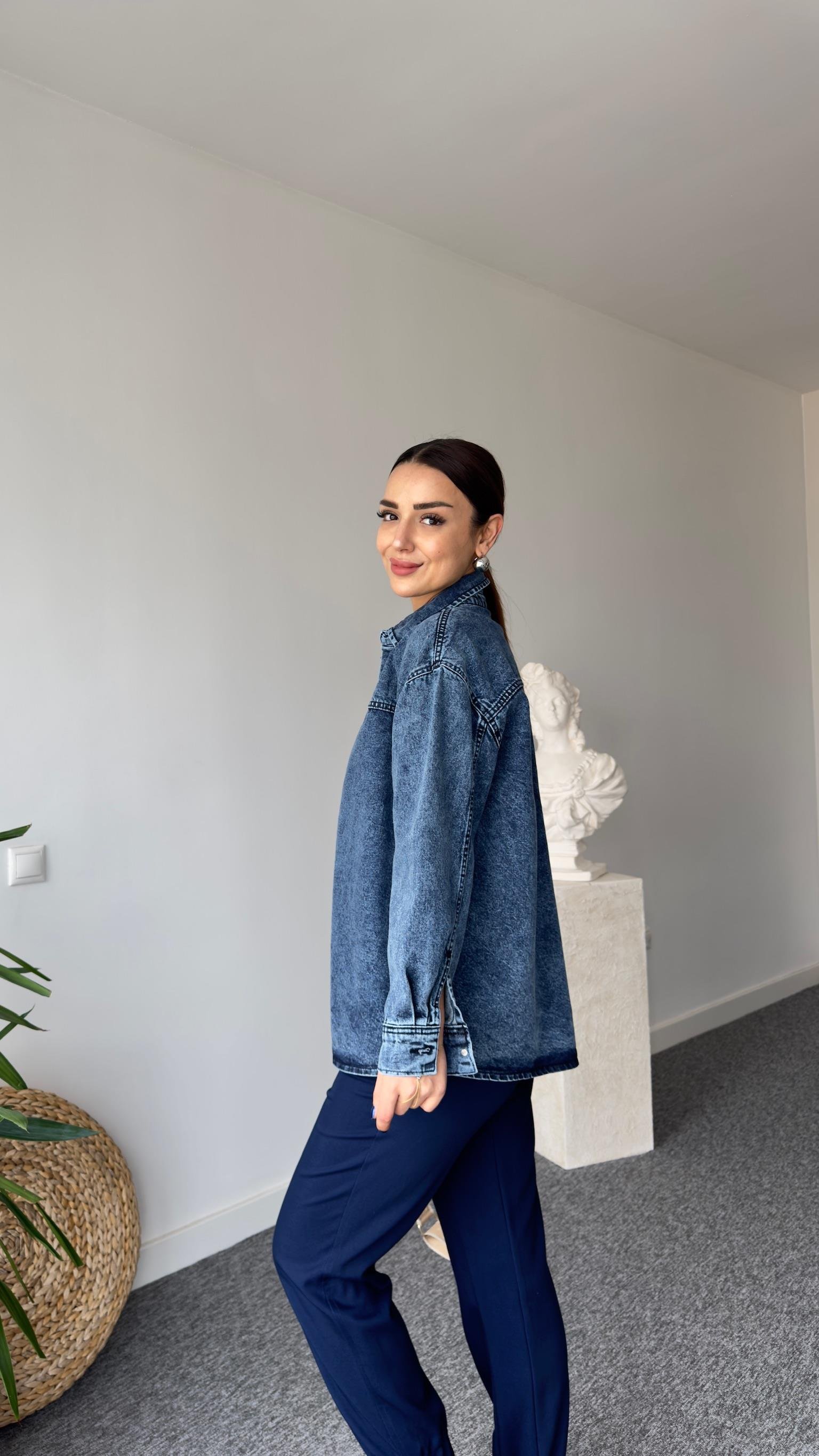 Marka Model Yanı Çakım Taşlı Kot Ceket