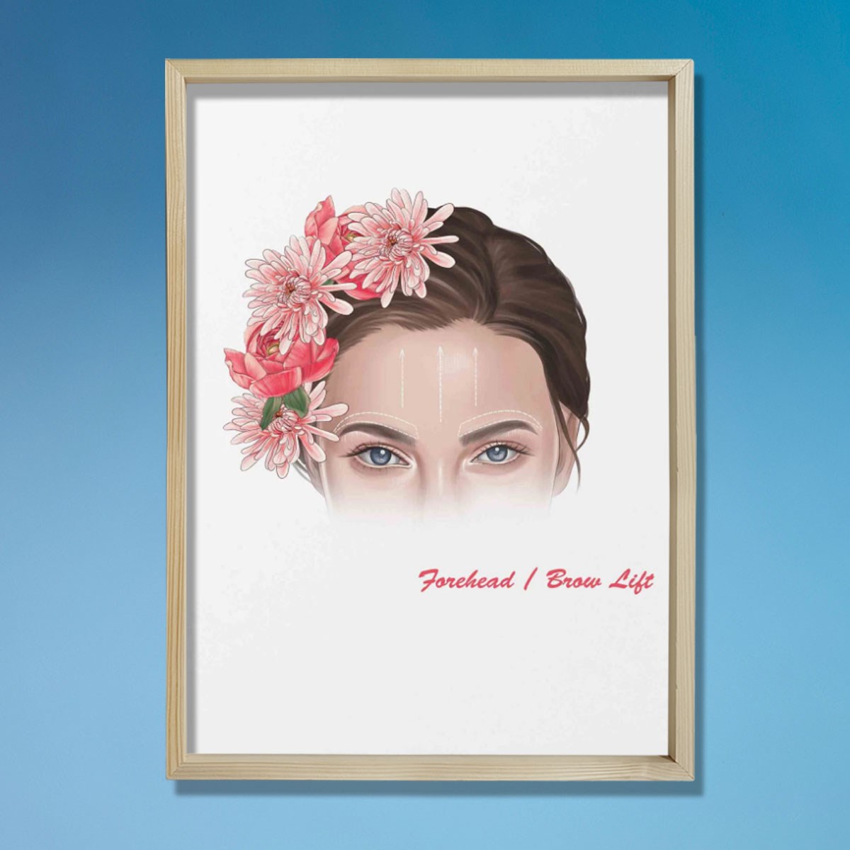 Alın Kaldırma İşaretleri, Plastik ve Estetik Cerrahı, Doktor Odası Duvar Tablosu