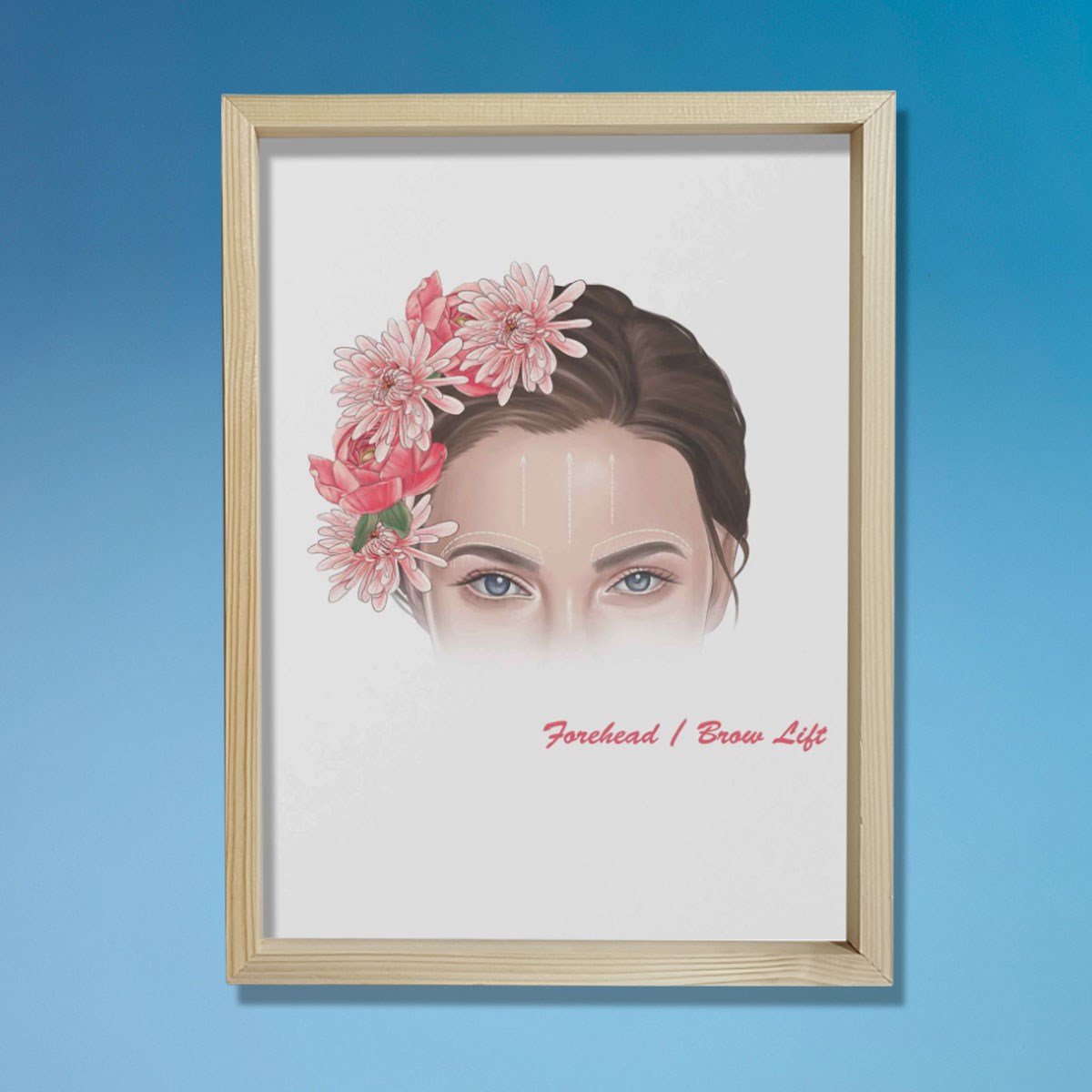 Alın Kaldırma İşaretleri, Plastik ve Estetik Cerrahı, Doktor Odası Duvar Tablosu