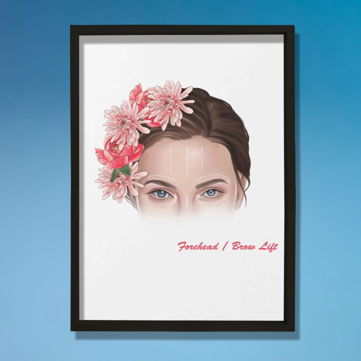 Alın Kaldırma İşaretleri, Plastik ve Estetik Cerrahı, Doktor Odası Duvar Tablosu