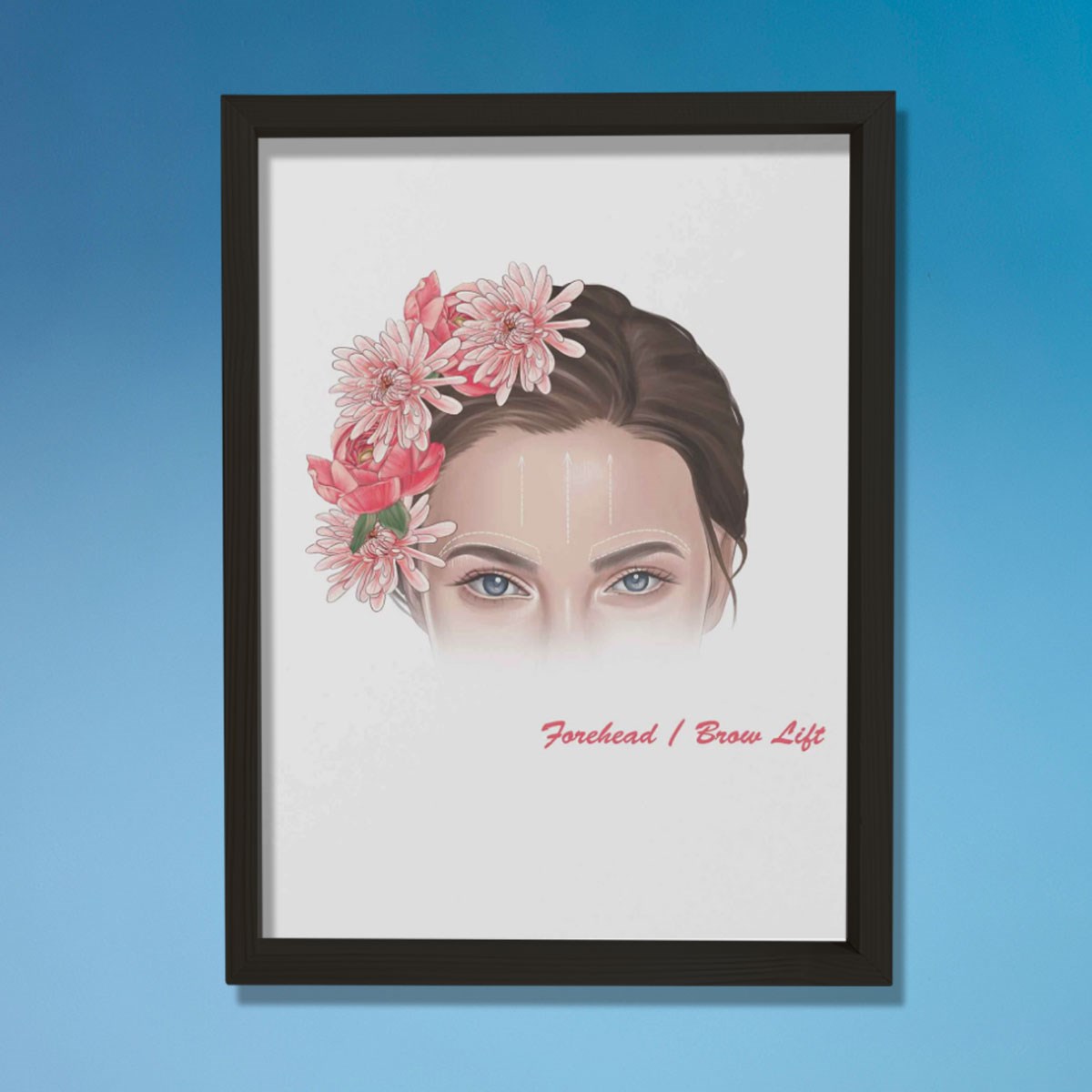 Alın Kaldırma İşaretleri, Plastik ve Estetik Cerrahı, Doktor Odası Duvar Tablosu