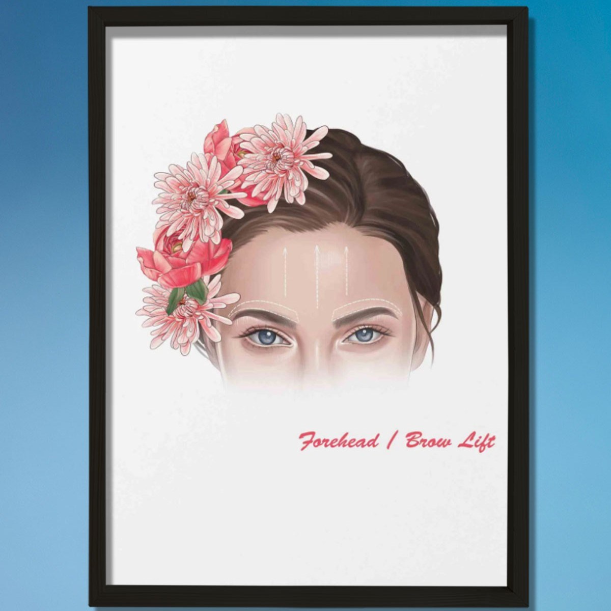 Alın Kaldırma İşaretleri, Plastik ve Estetik Cerrahı, Doktor Odası Duvar Tablosu