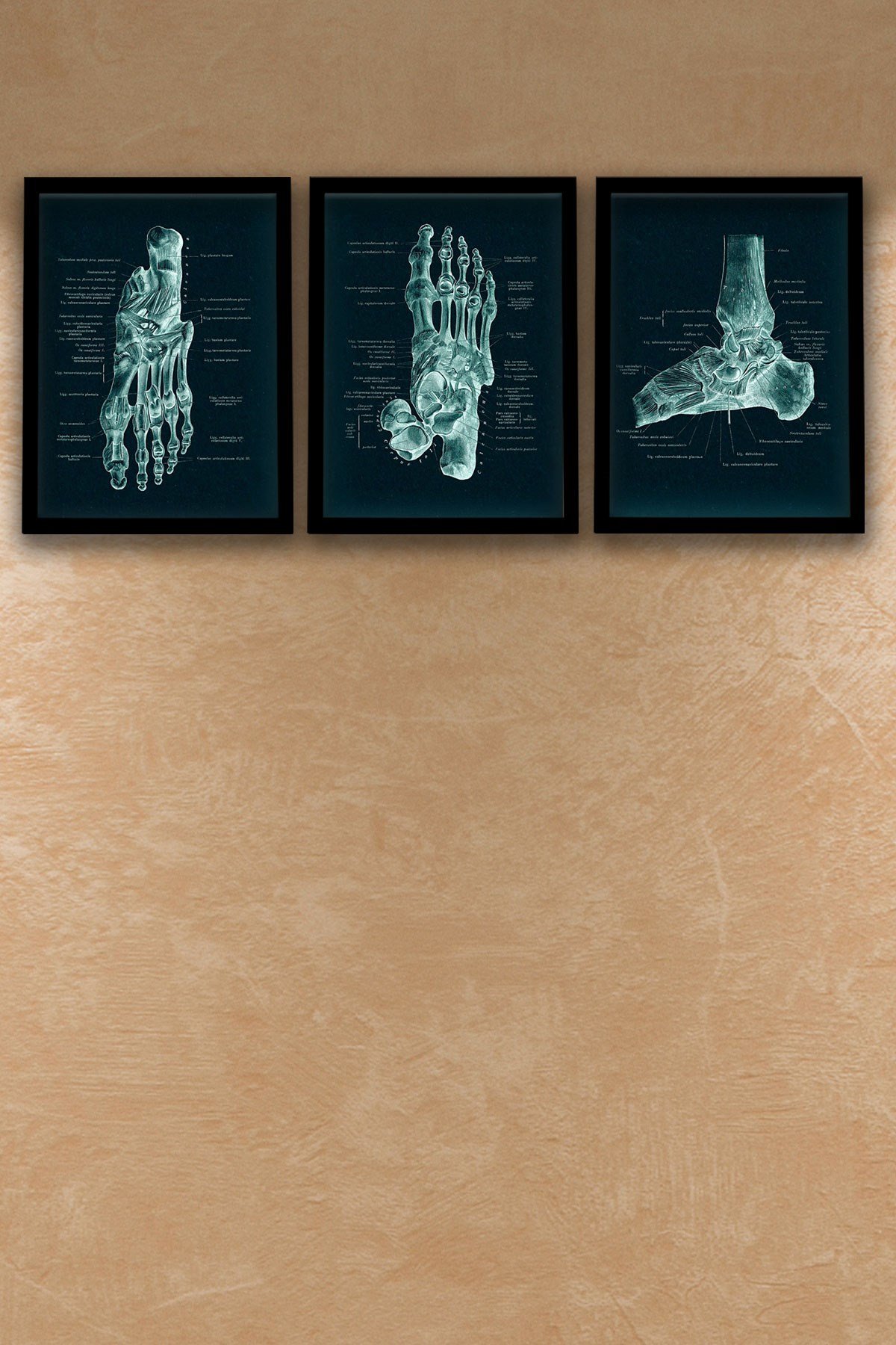 Anatomik Siyah Tablo, Ortopedi, Ayak Kemikleri, Doktor Odası  Duvar Tablosu 3 lü