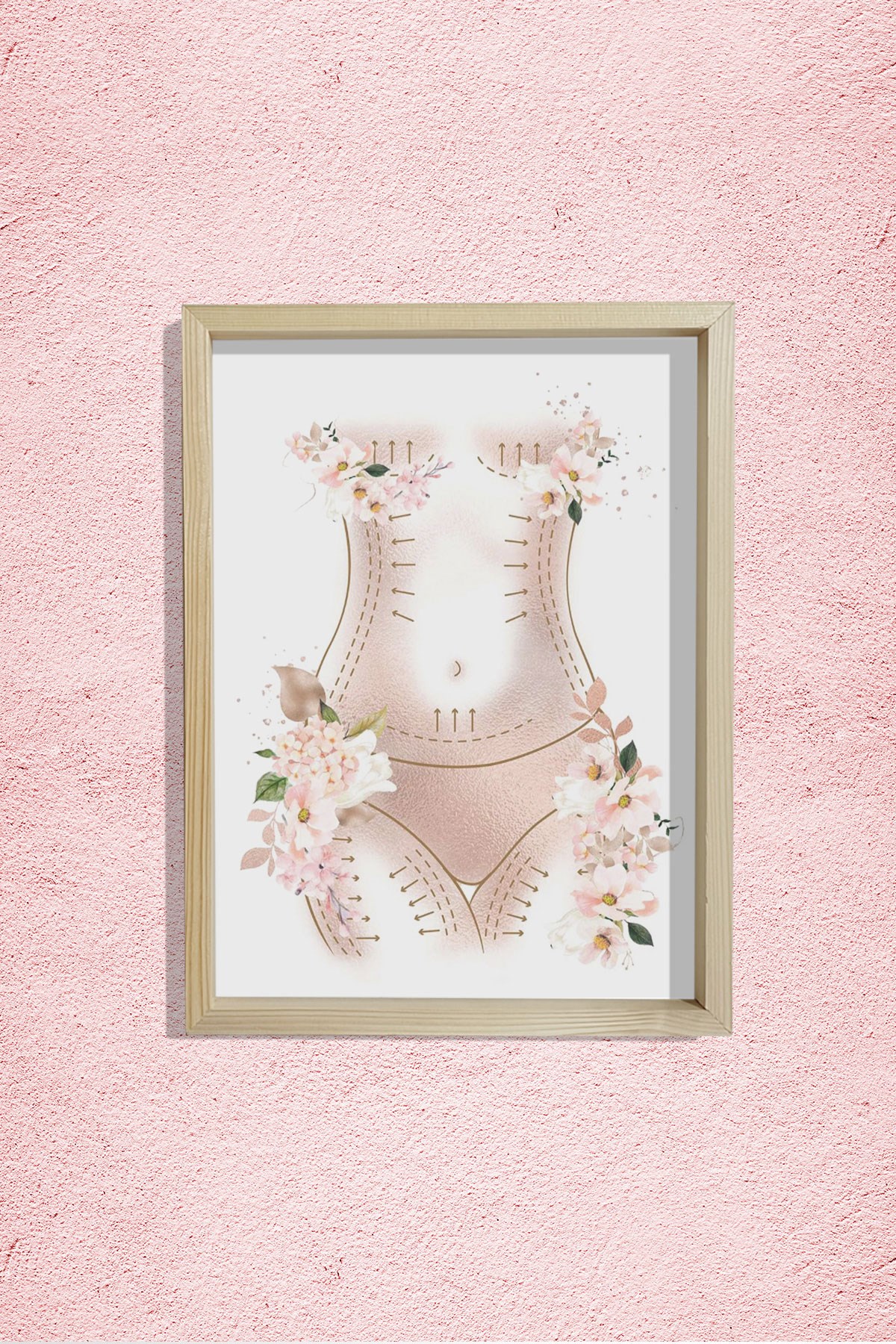 Anne Estetiği , Karın Germe Sanatı, Liposuction, Plastik ve Estetik Cerrahı, Doktor Odası Duvar Tablosu