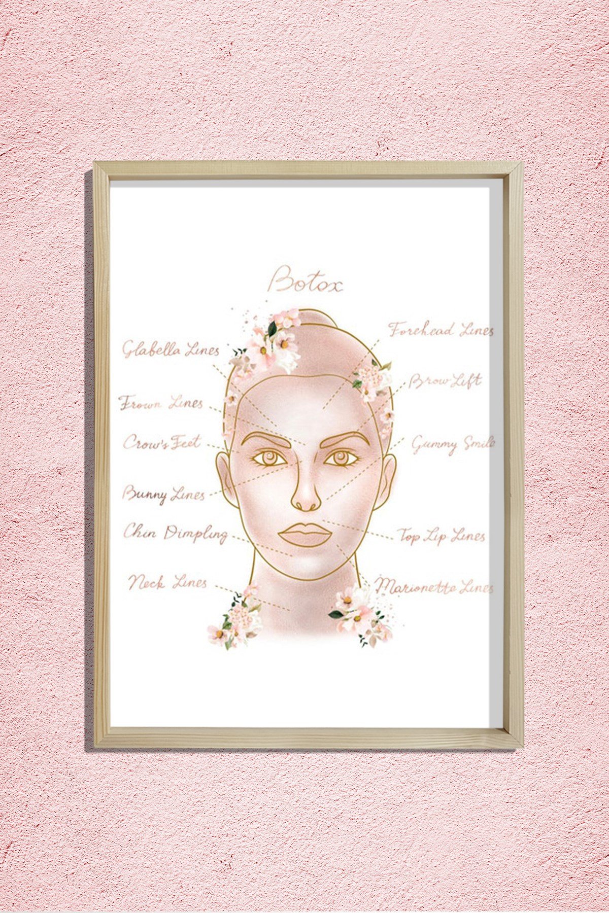 Botox Enjeksiyon Noktaları, Öncesi ve Sonrası, Plastik ve Estetik Cerrahı, Doktor Odası Duvar Tablosu