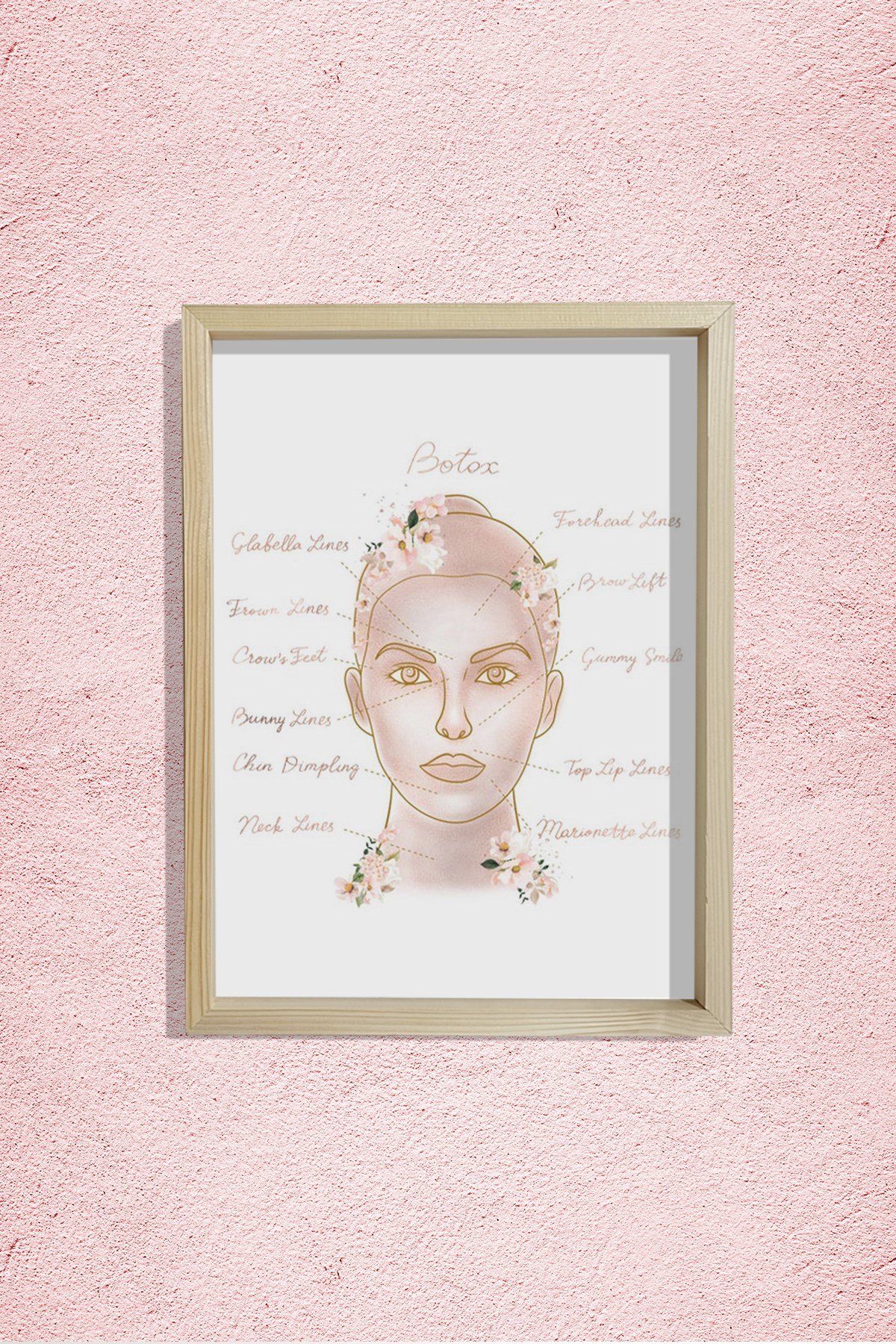 Botox Enjeksiyon Noktaları, Öncesi ve Sonrası, Plastik ve Estetik Cerrahı, Doktor Odası Duvar Tablosu