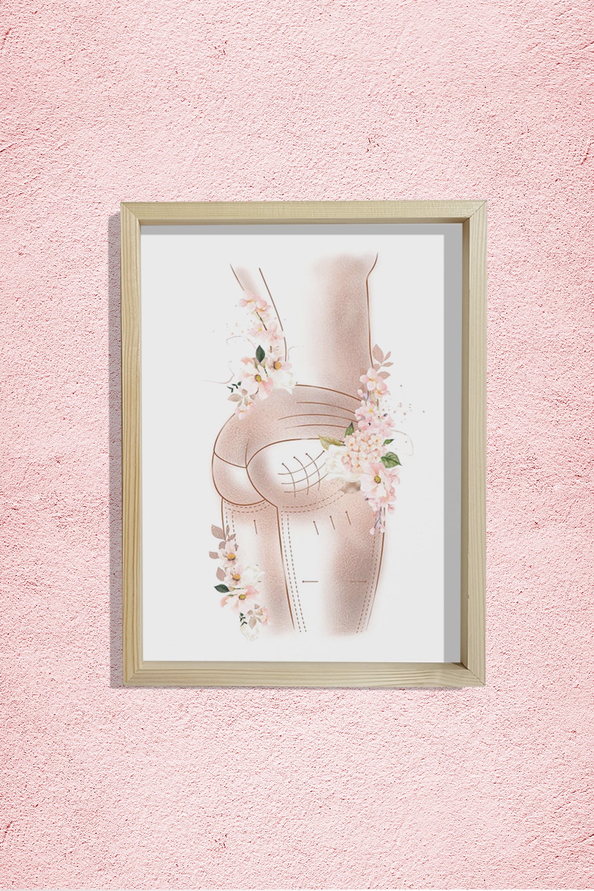 Breziya Poposu, Popo Kaldırma Sanatı, Plastik ve Estetik Cerrahı, Doktor Odası Duvar Tablosu