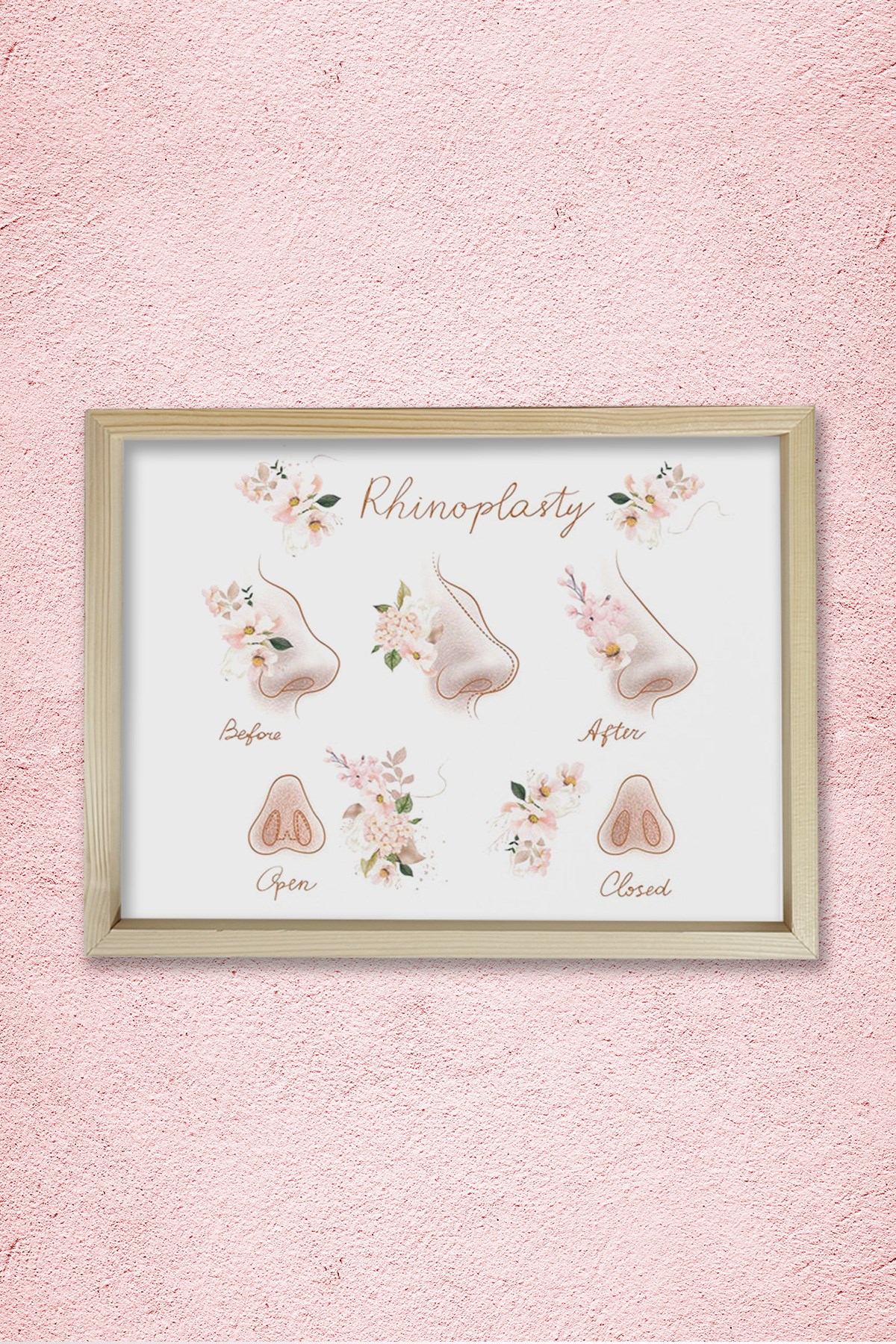 Burun Estetiği, Plastik ve Estetik Cerrahı, Doktor Odası Duvar Tablosu