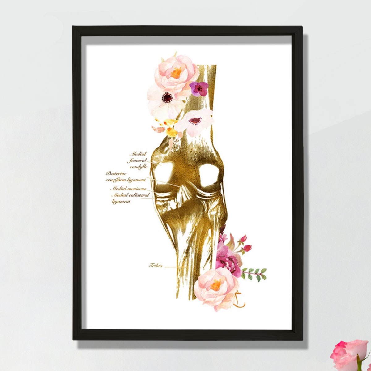 Diz Anatomisi Sanatı, Ortopedi Cerrahı, Fiziksel Terapist Hediyesi