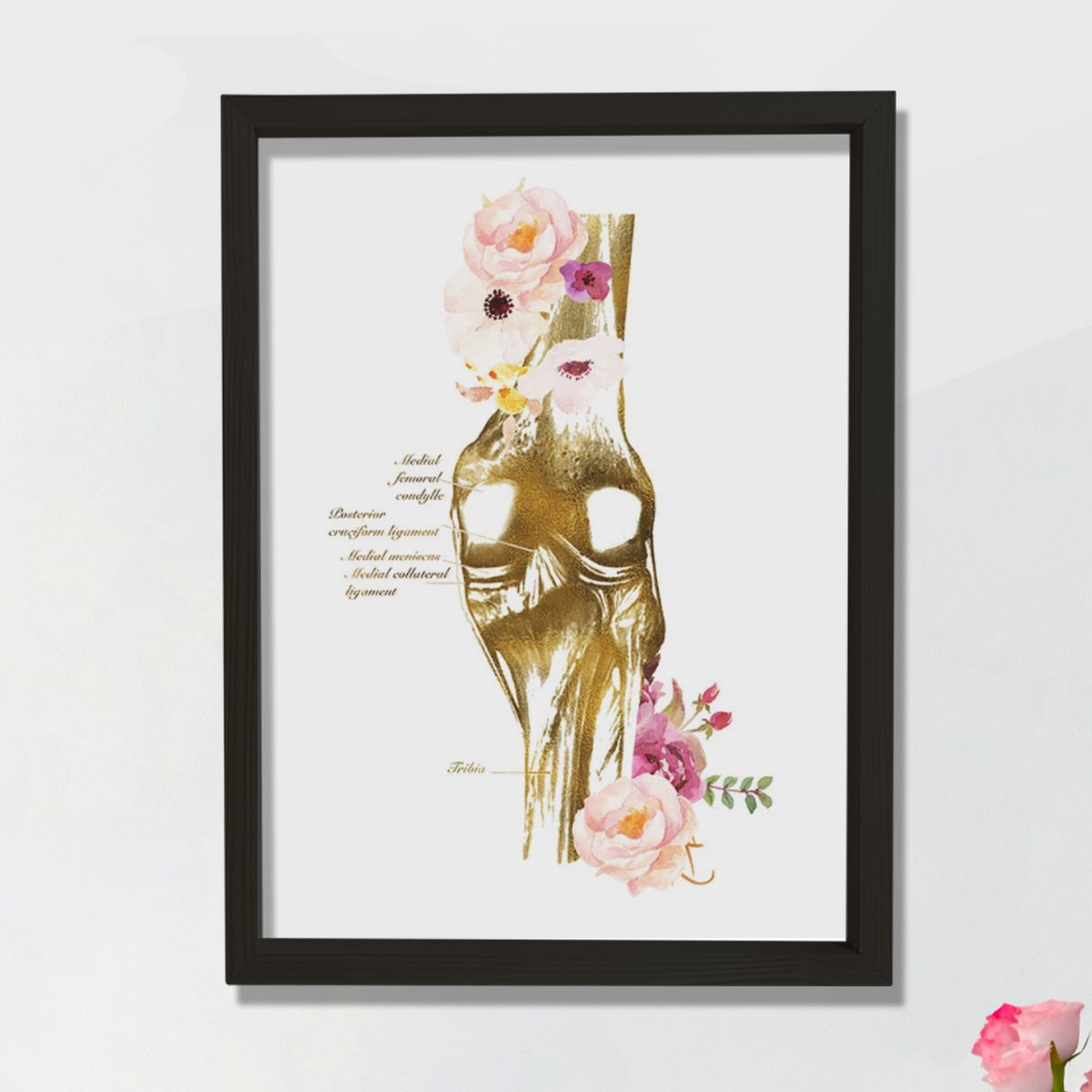 Diz Anatomisi Sanatı, Ortopedi Cerrahı, Fiziksel Terapist Hediyesi