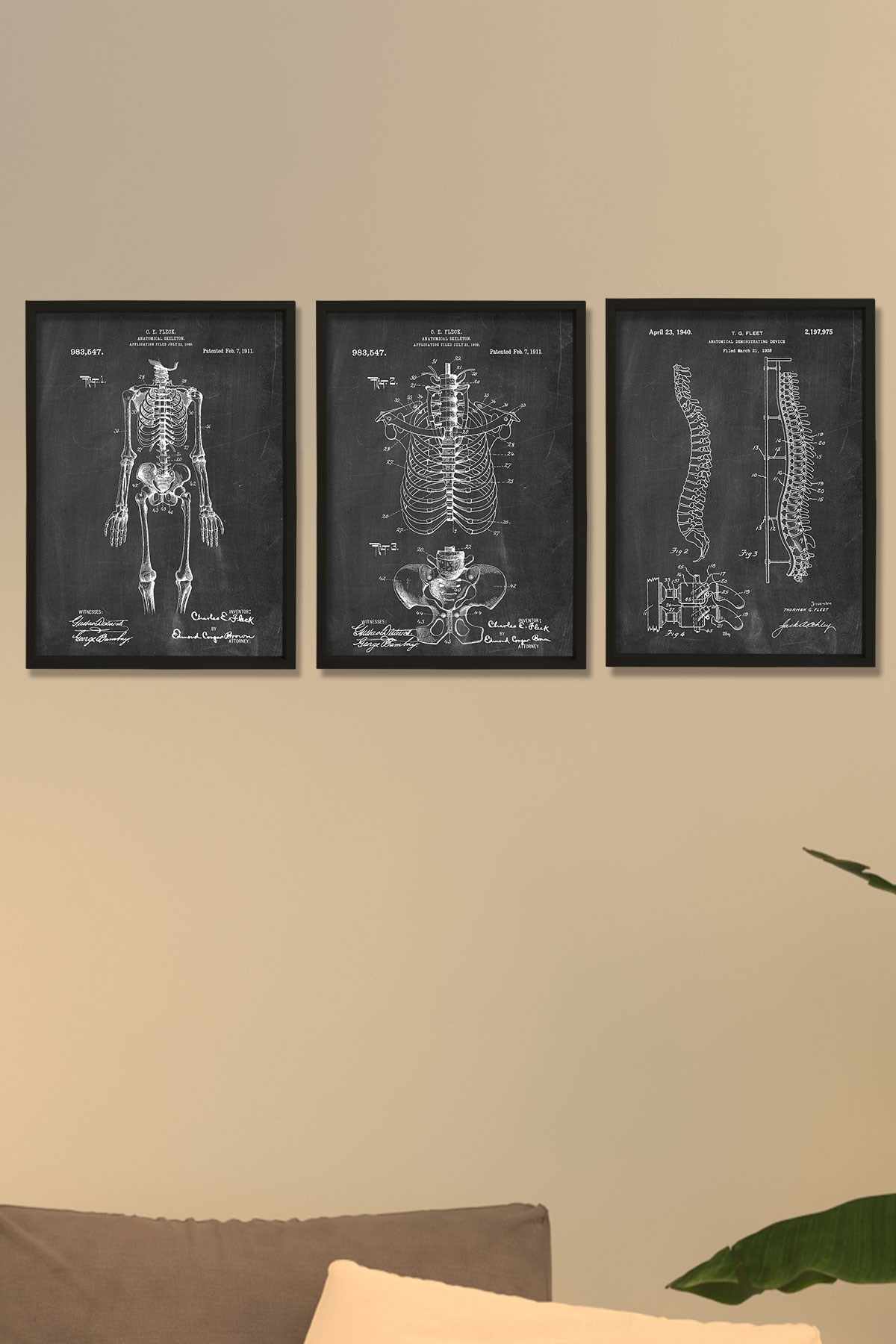 Doğal Çam Çerçeveli Duvar Tablosu İnsan İskelet Anatomi 3'lü Tablo Seti