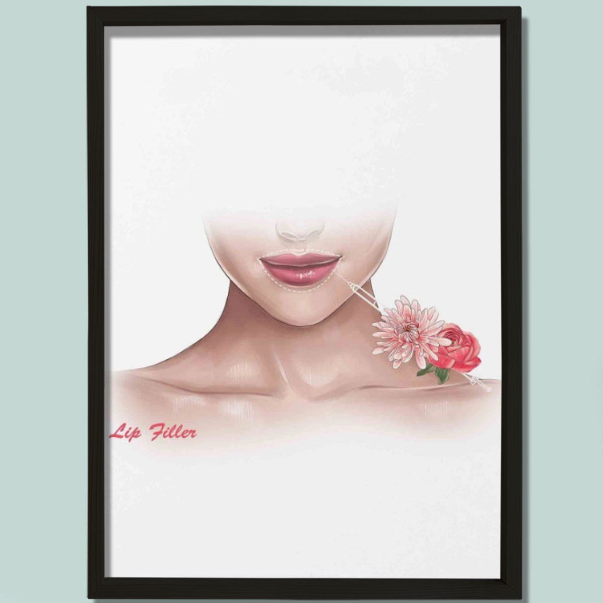 Dudak Dolgusu Büyütme, Rekonstrüktif Cerrahi, Plastik ve Estetik Cerrahı, Doktor Odası Duvar Tablosu