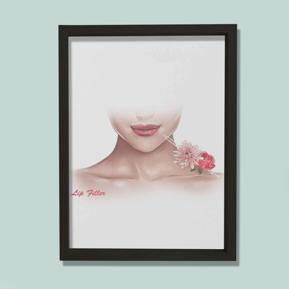 Dudak Dolgusu Büyütme, Rekonstrüktif Cerrahi, Plastik ve Estetik Cerrahı, Doktor Odası Duvar Tablosu
