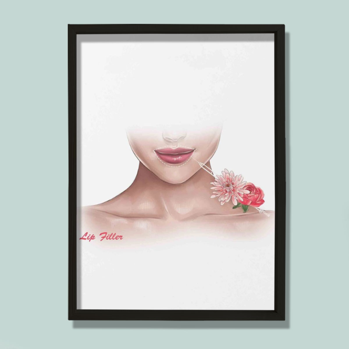 Dudak Dolgusu Büyütme, Rekonstrüktif Cerrahi, Plastik ve Estetik Cerrahı, Doktor Odası Duvar Tablosu