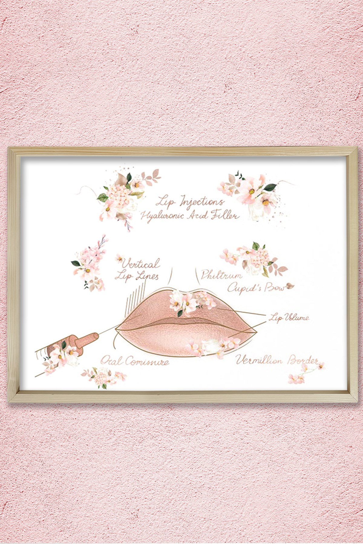 Dudak Dolgusu, Dudak Büyütme, Plastik ve Estetik Cerrahı, Doktor Odası Duvar Tablosu