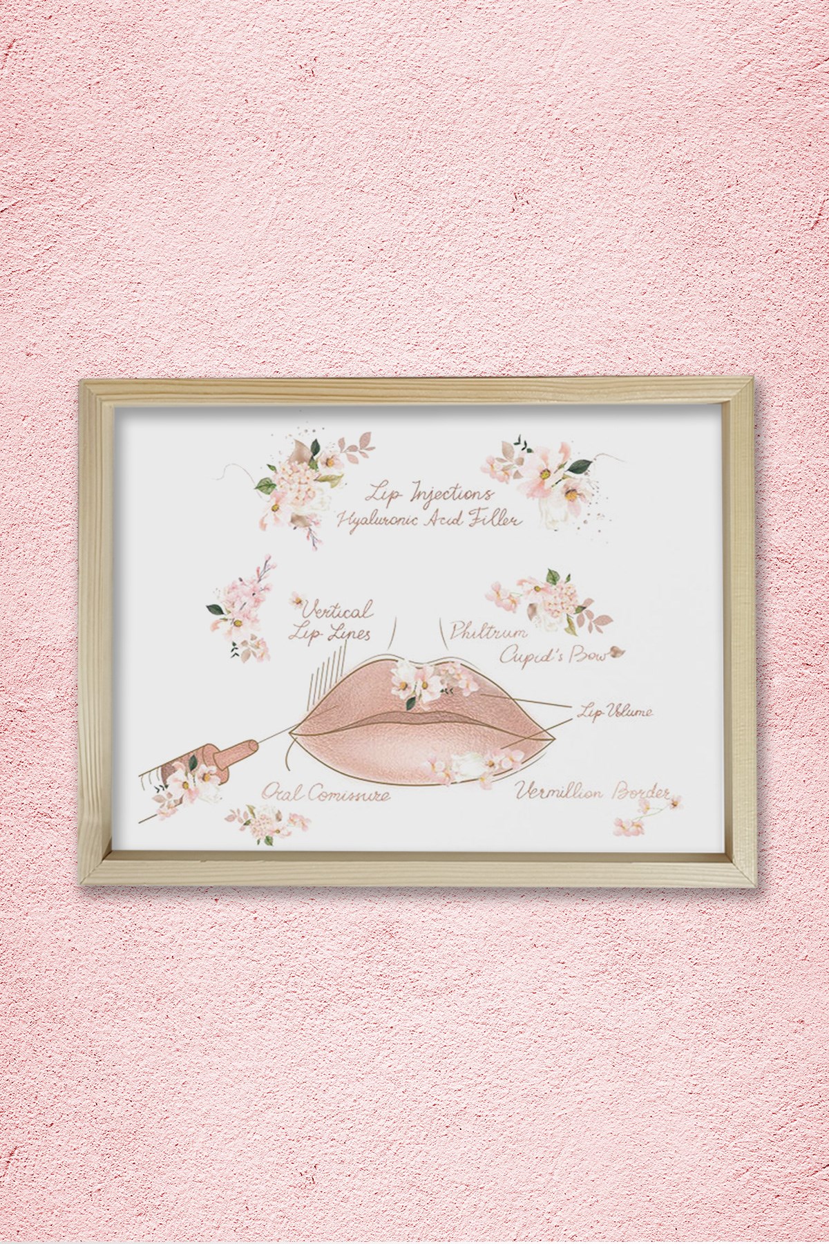Dudak Dolgusu, Dudak Büyütme, Plastik ve Estetik Cerrahı, Doktor Odası Duvar Tablosu