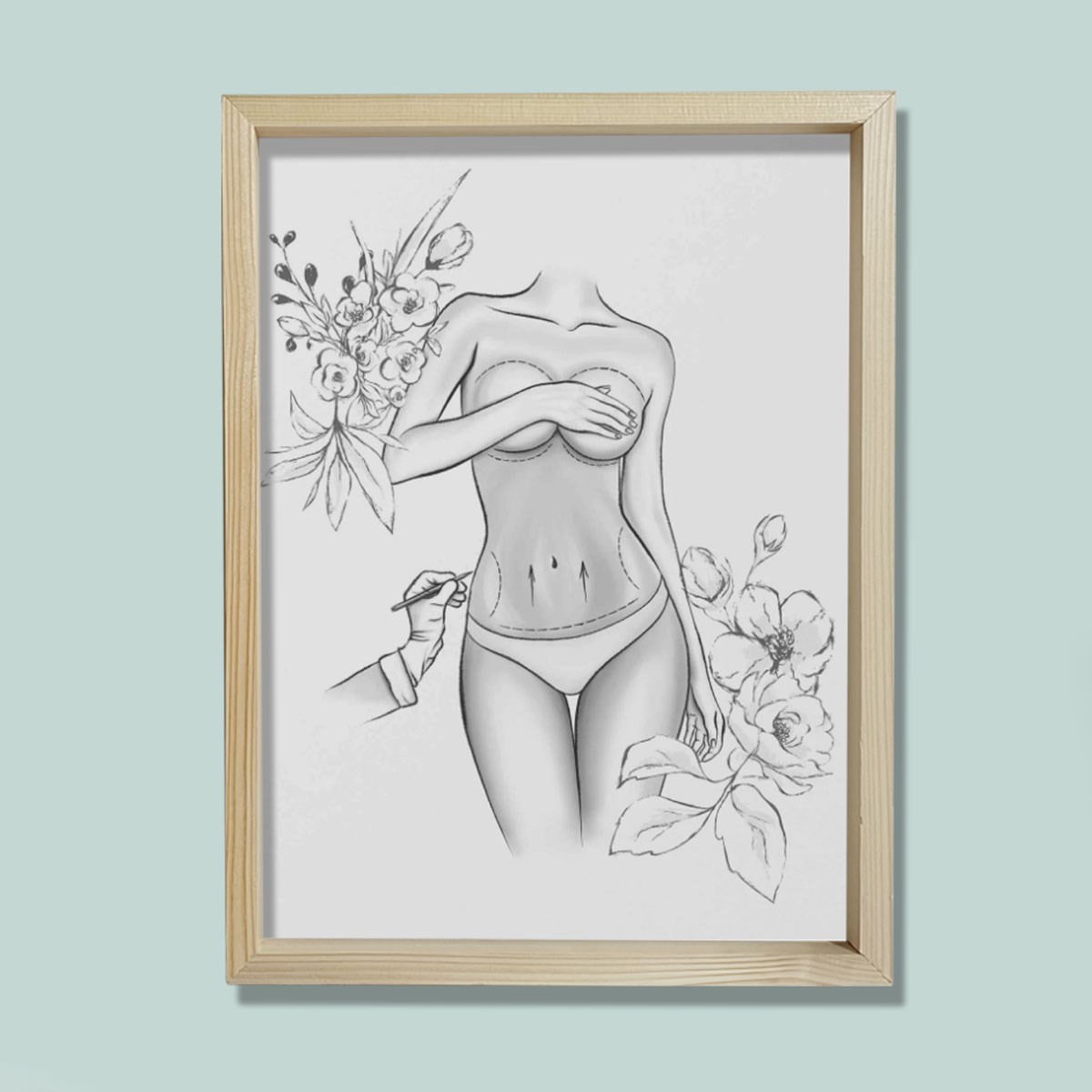 Estetik Ameliyat İşaretleri, Karın Germe, Plastik ve Estetik Cerrahı, Doktor Odası Duvar Tablosu