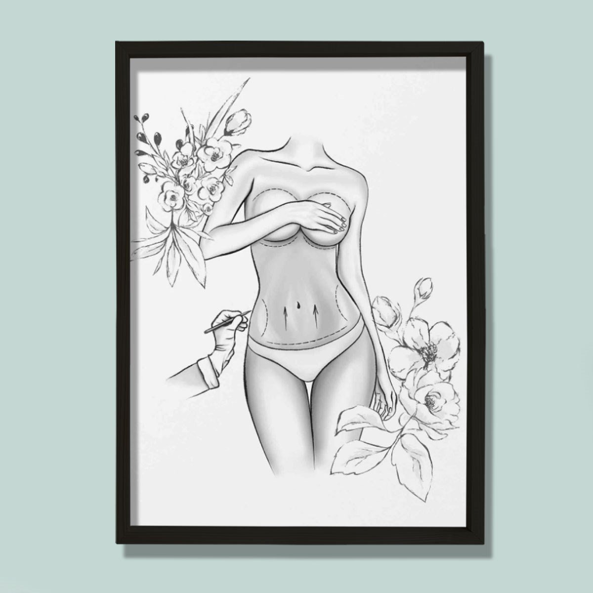 Estetik Ameliyat İşaretleri, Karın Germe, Plastik ve Estetik Cerrahı, Doktor Odası Duvar Tablosu