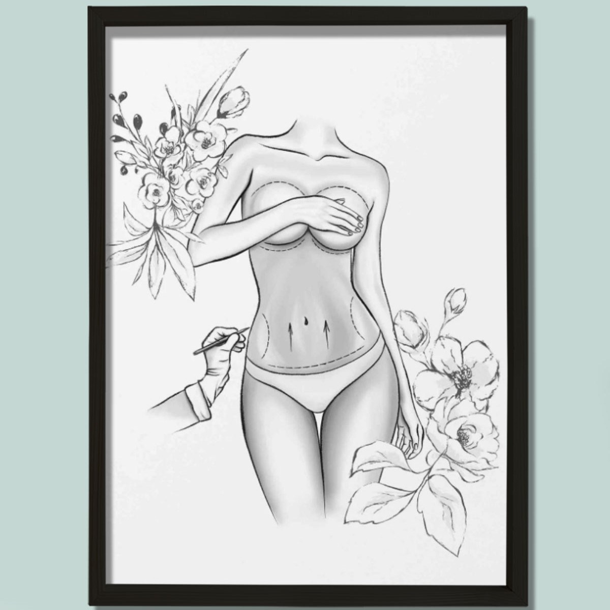 Estetik Ameliyat İşaretleri, Karın Germe, Plastik ve Estetik Cerrahı, Doktor Odası Duvar Tablosu