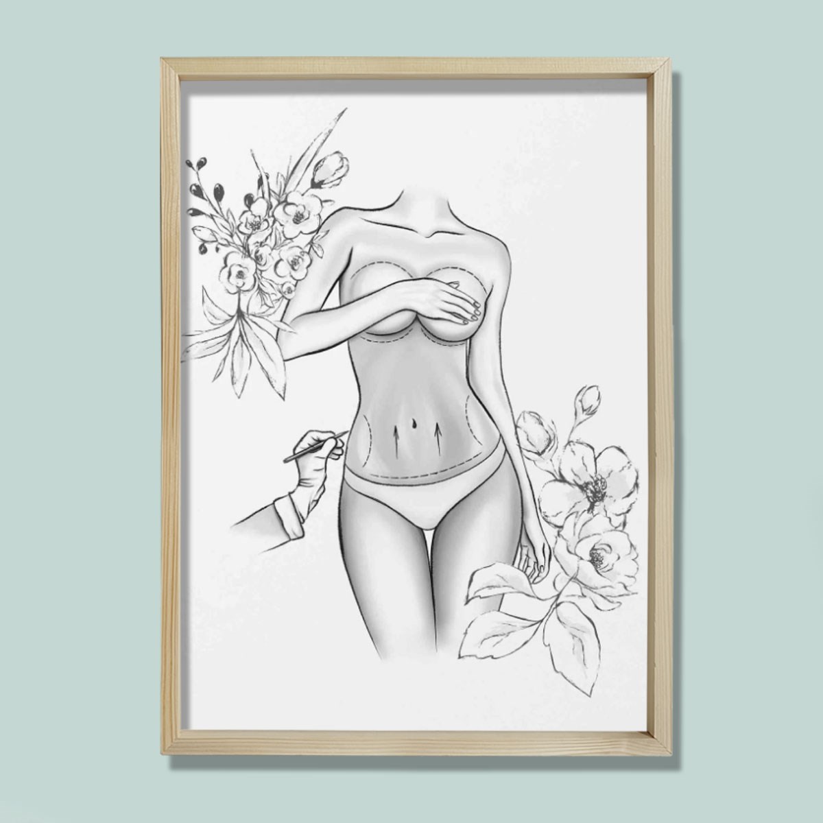 Estetik Ameliyat İşaretleri, Karın Germe, Plastik ve Estetik Cerrahı, Doktor Odası Duvar Tablosu