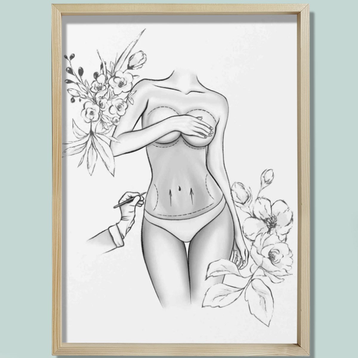 Estetik Ameliyat İşaretleri, Karın Germe, Plastik ve Estetik Cerrahı, Doktor Odası Duvar Tablosu