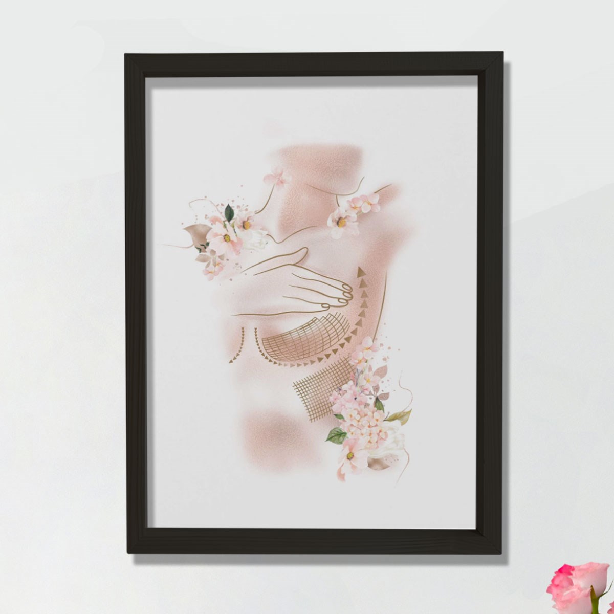 Göğüs Büyütme, Kadın Göğüs Baskısı, Plastik ve Estetik Cerrahı, Doktor Odası Duvar Tablosu