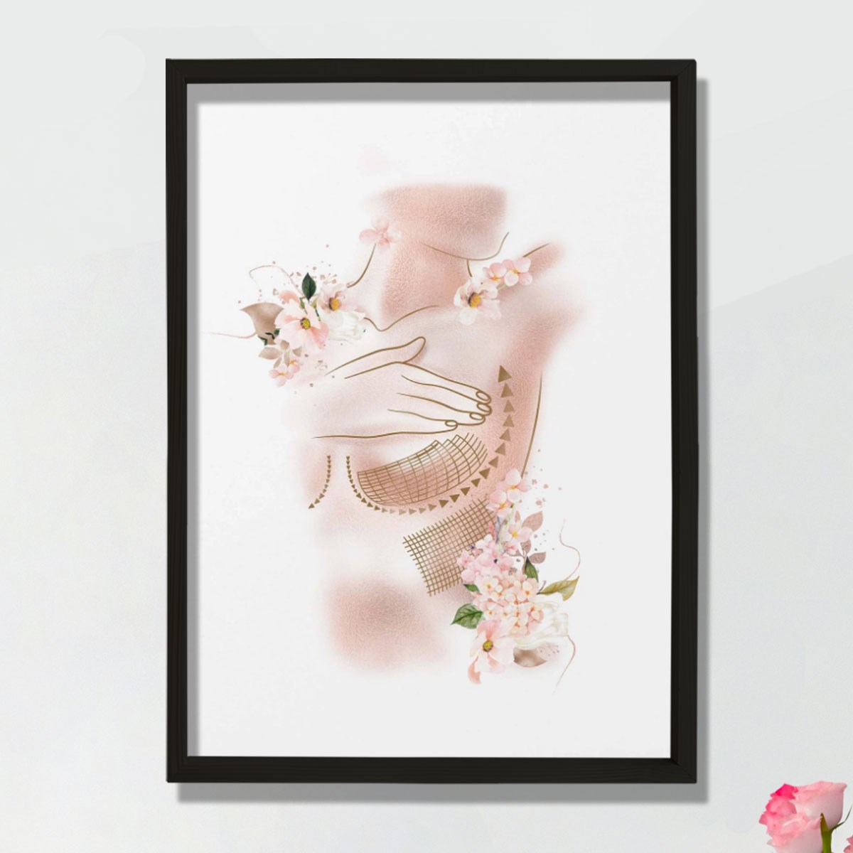 Göğüs Büyütme, Kadın Göğüs Baskısı, Plastik ve Estetik Cerrahı, Doktor Odası Duvar Tablosu