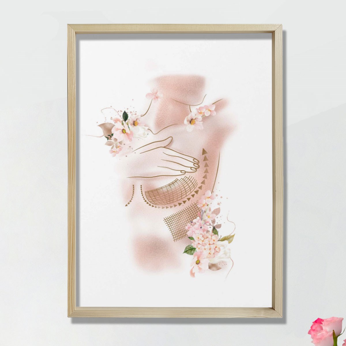 Göğüs Büyütme, Kadın Göğüs Baskısı, Plastik ve Estetik Cerrahı, Doktor Odası Duvar Tablosu