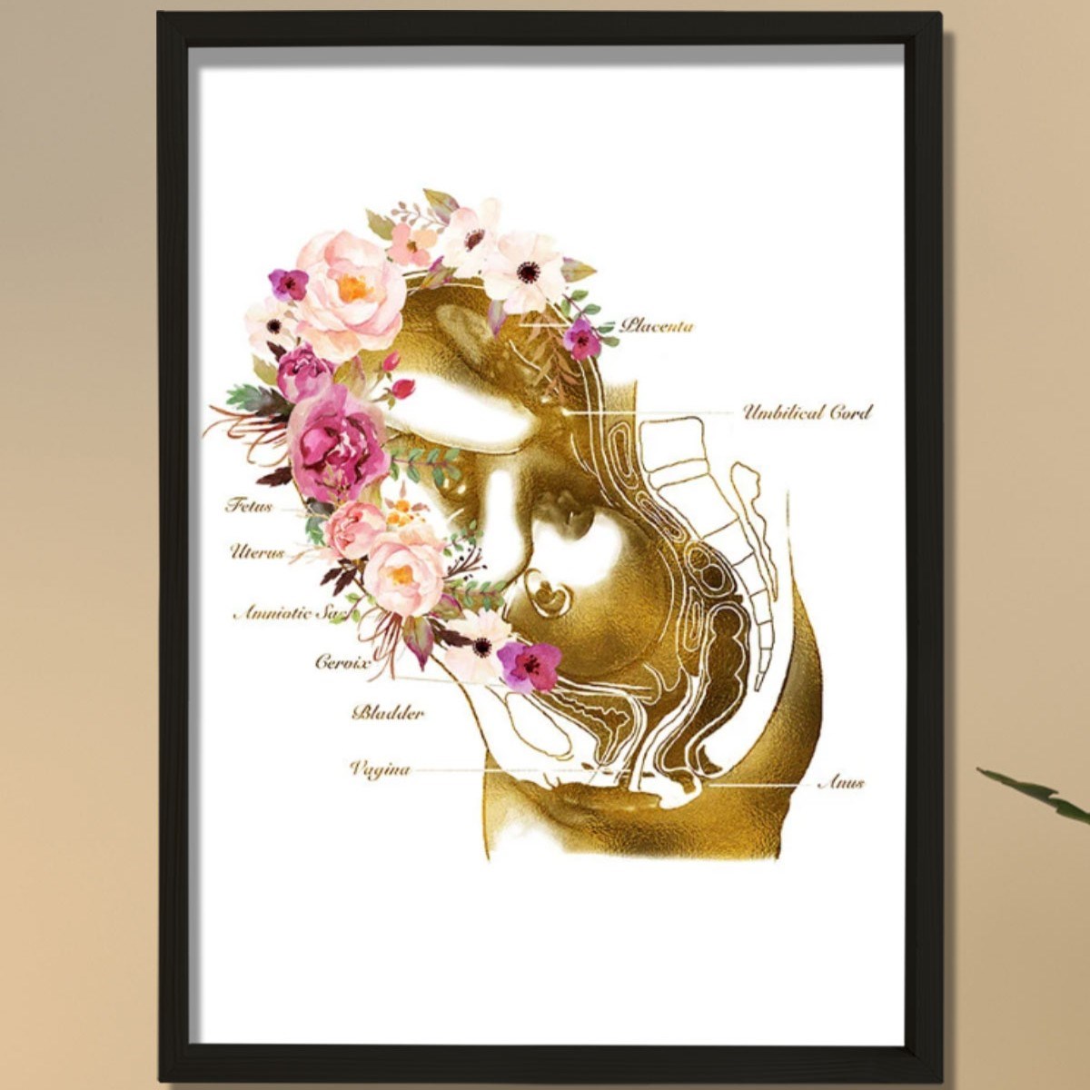 Hamilelik Baskısı, Ebe Hediyesi, Obstetrik Sanat, Jinekolog Hediyesi