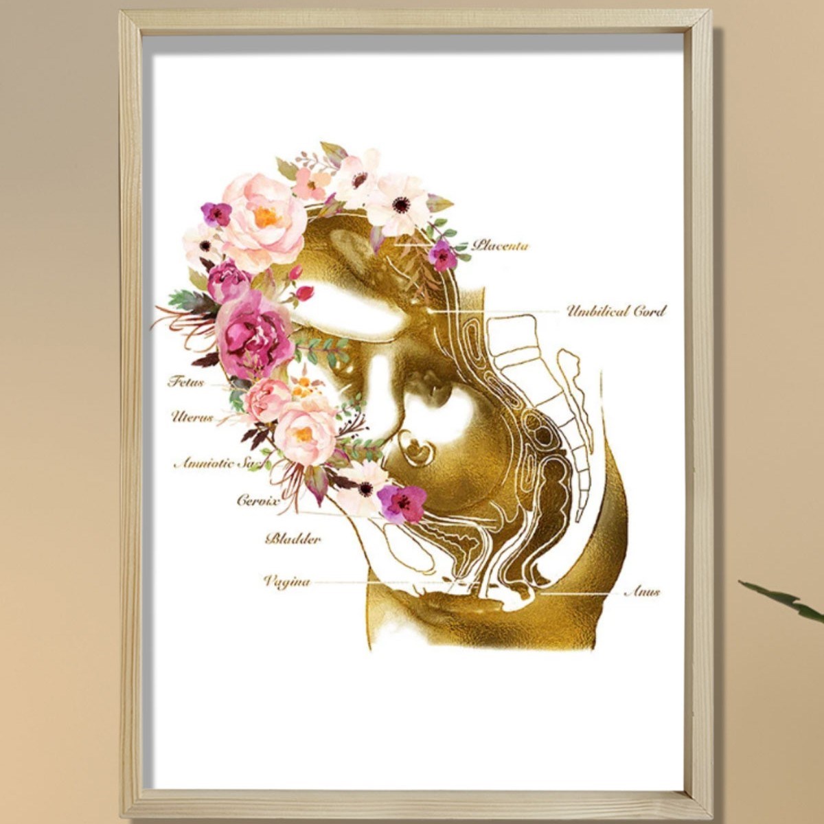 Hamilelik Baskısı, Ebe Hediyesi, Obstetrik Sanat, Jinekolog Hediyesi