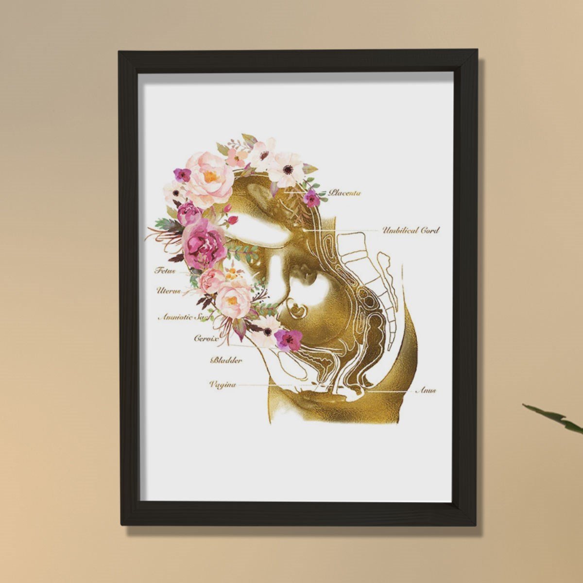 Hamilelik Baskısı, Ebe Hediyesi, Obstetrik Sanat, Jinekolog Hediyesi