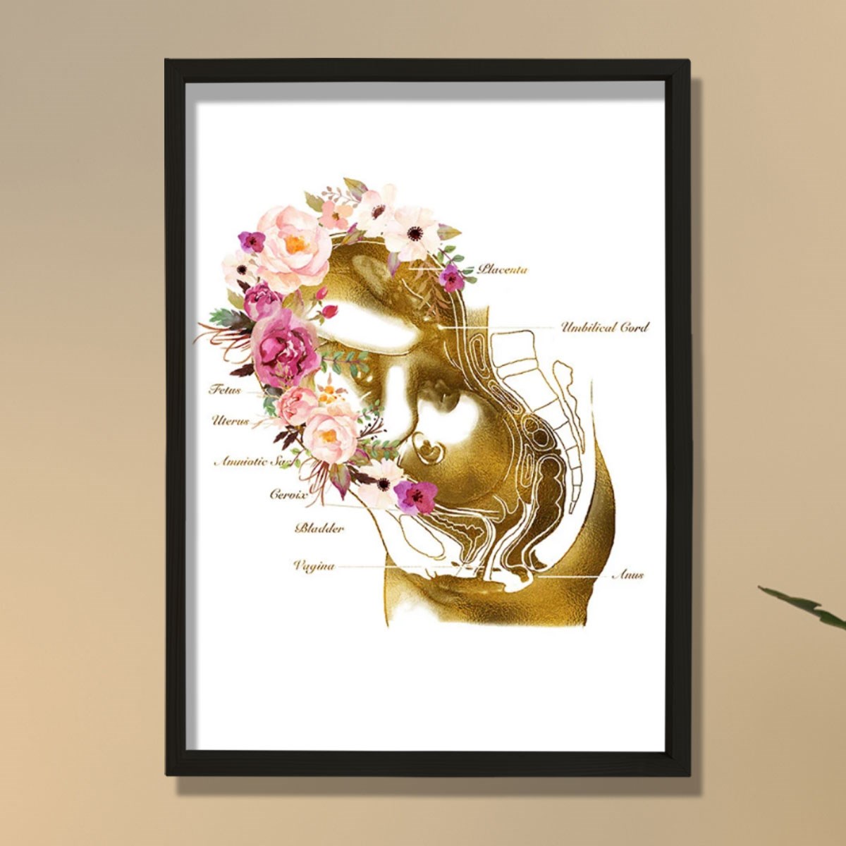 Hamilelik Baskısı, Ebe Hediyesi, Obstetrik Sanat, Jinekolog Hediyesi