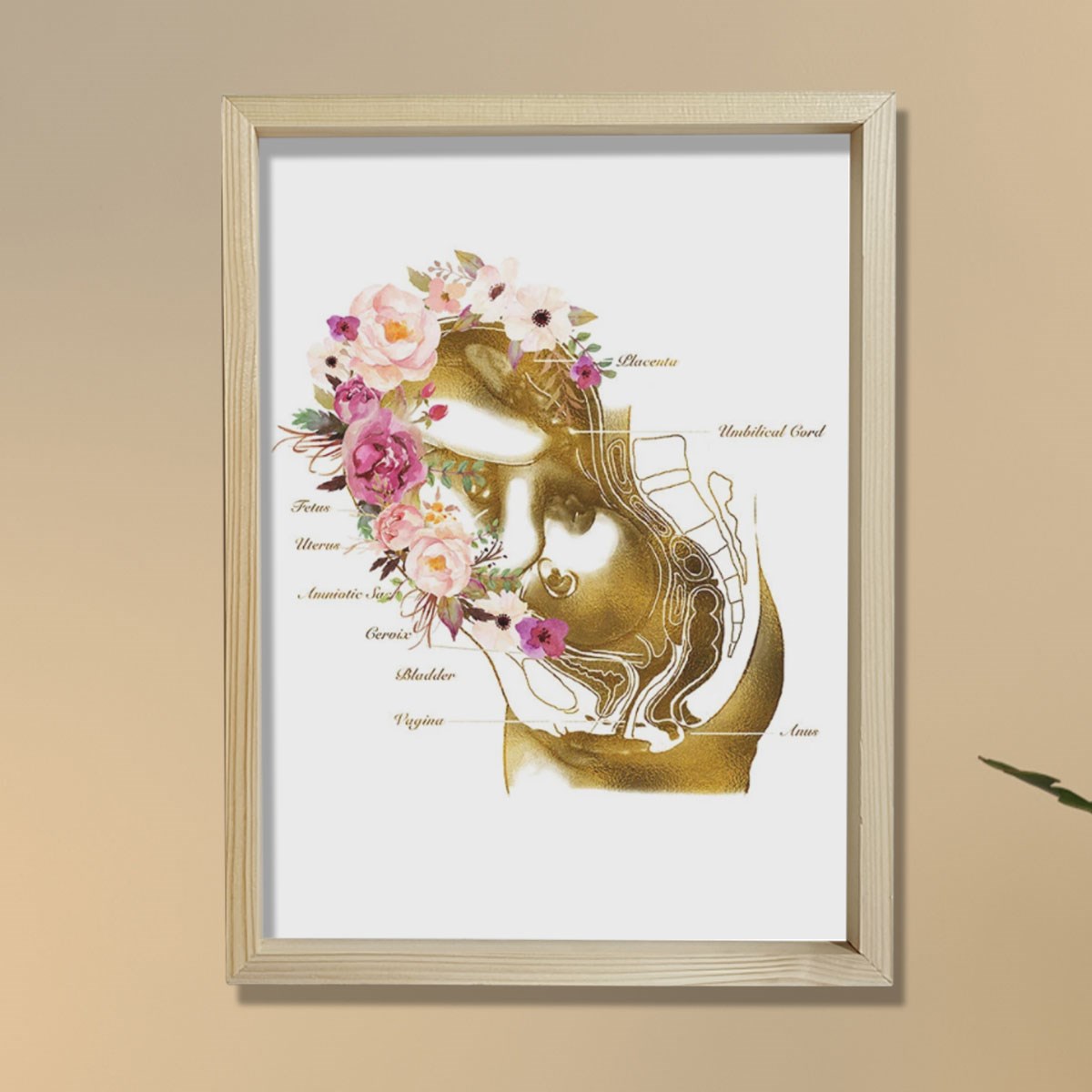 Hamilelik Baskısı, Ebe Hediyesi, Obstetrik Sanat, Jinekolog Hediyesi