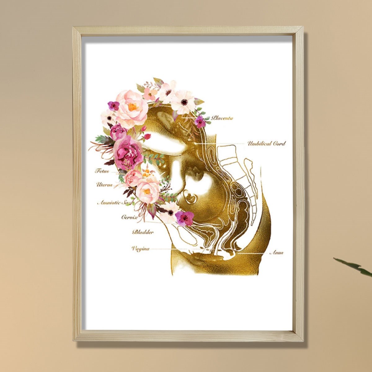 Hamilelik Baskısı, Ebe Hediyesi, Obstetrik Sanat, Jinekolog Hediyesi