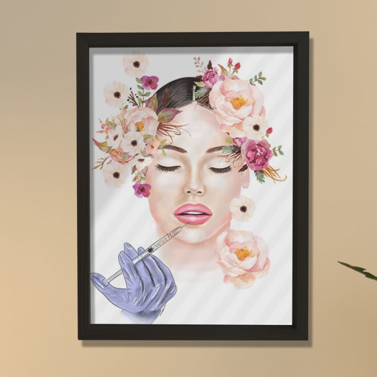 Lip Botox Posteri, Hyaluronik Asit, Estetik Merkez Dekoru