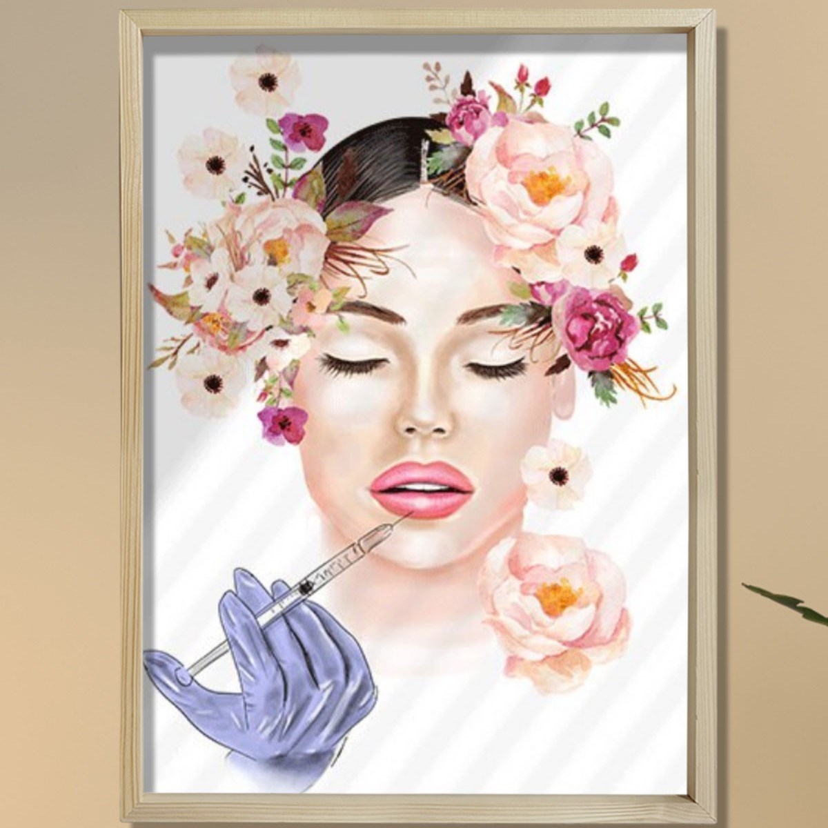 Lip Botox Posteri, Hyaluronik Asit, Estetik Merkez Dekoru