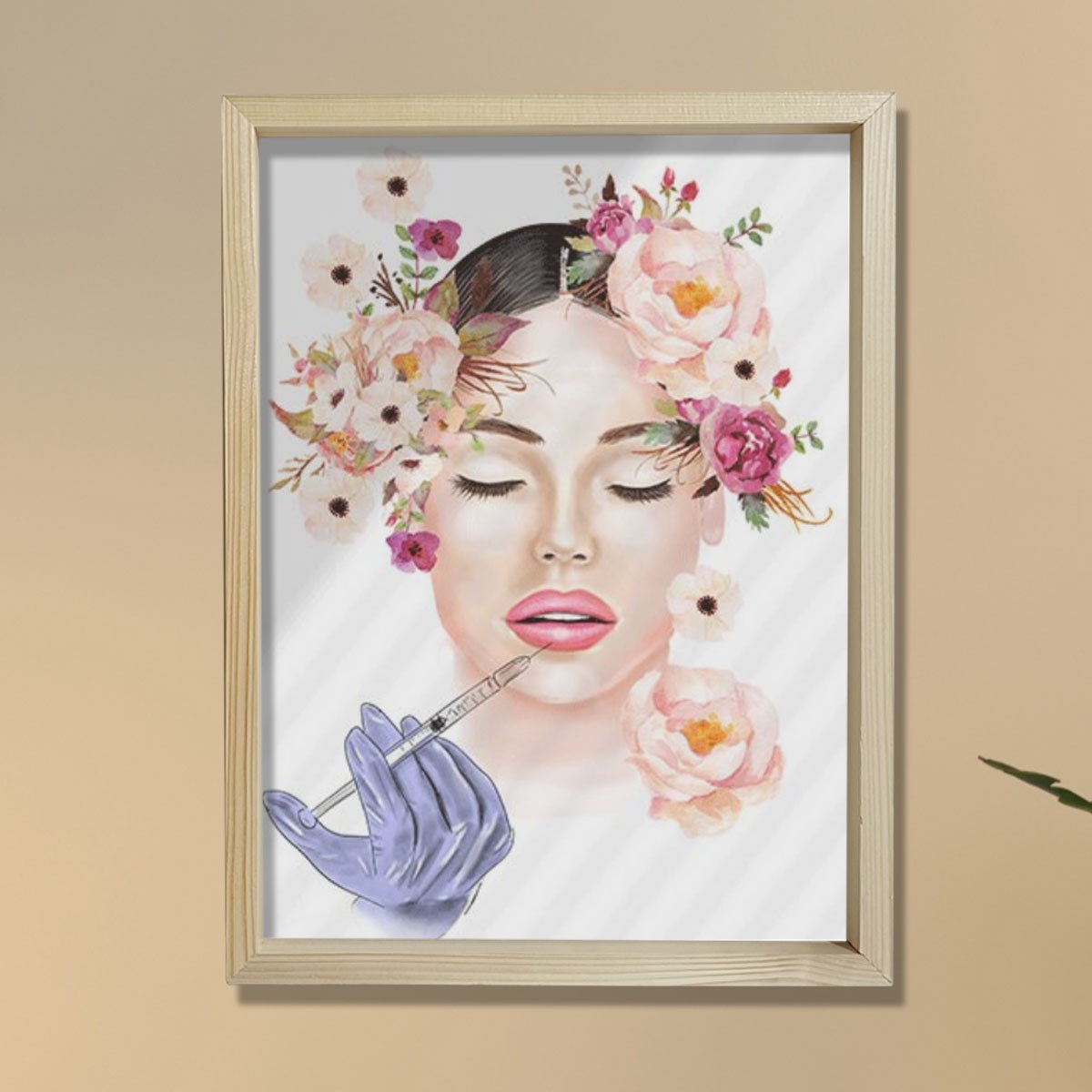 Lip Botox Posteri, Hyaluronik Asit, Estetik Merkez Dekoru