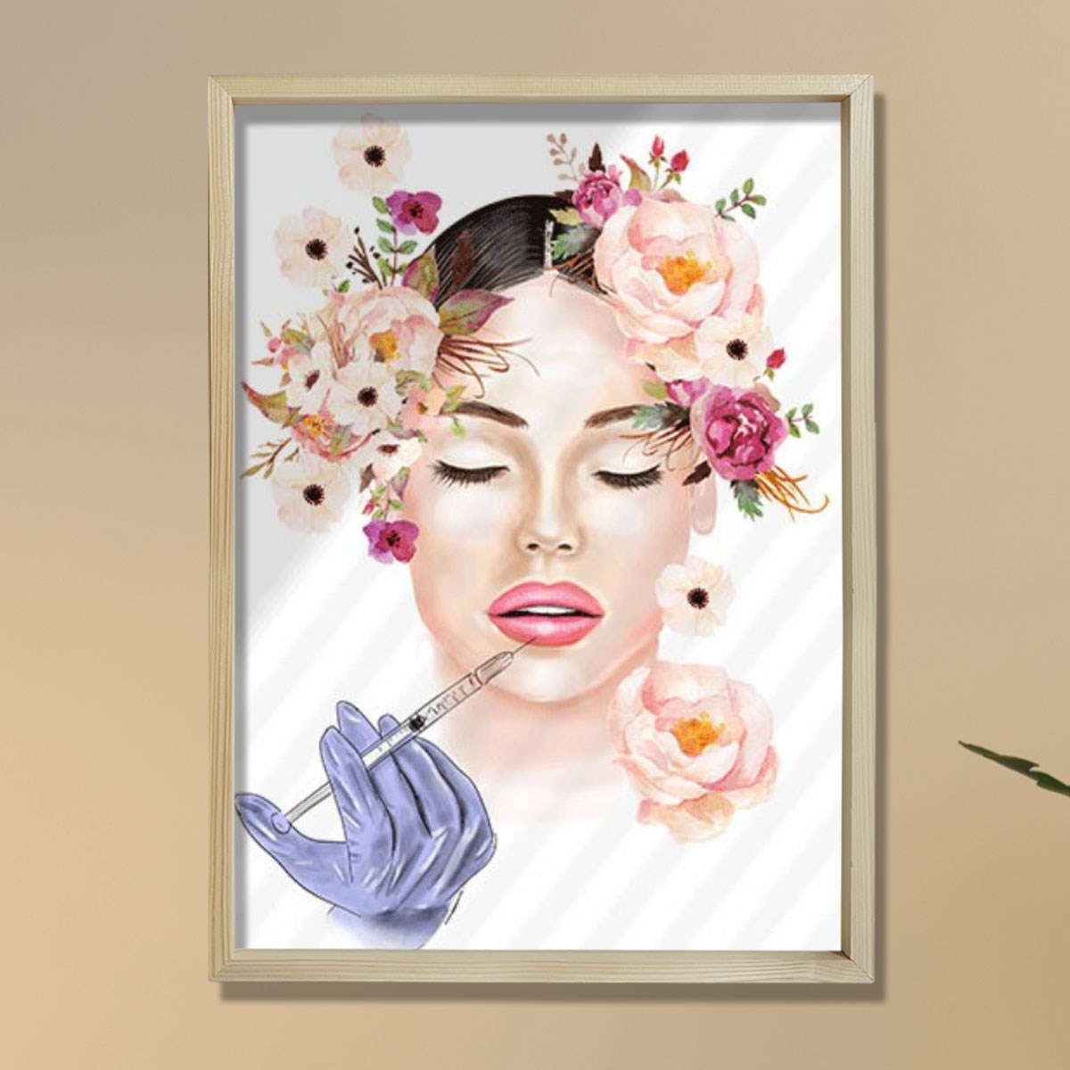 Lip Botox Posteri, Hyaluronik Asit, Estetik Merkez Dekoru