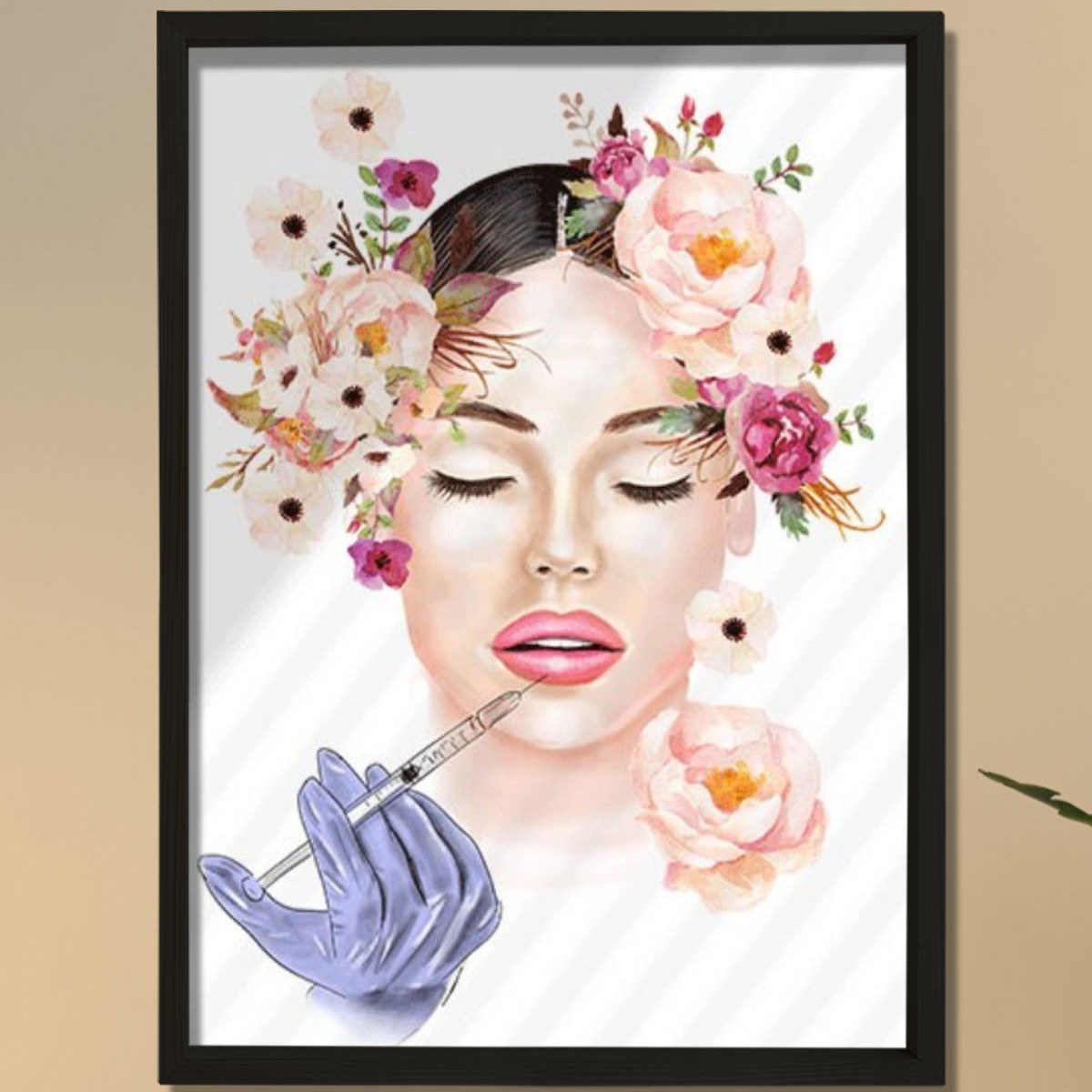 Lip Botox Posteri, Hyaluronik Asit, Estetik Merkez Dekoru