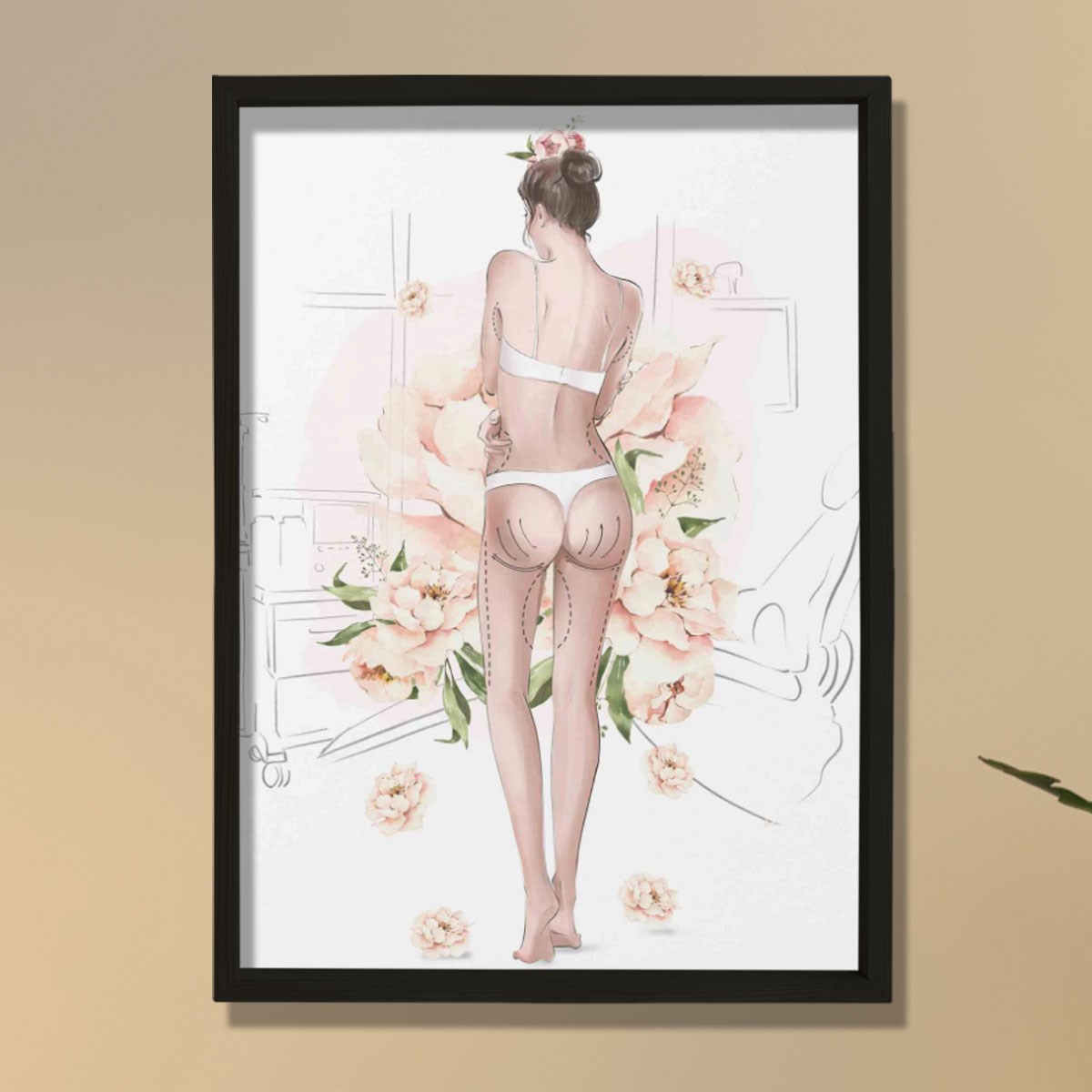 Plastik Cerrah Ameliyat İşaretleri,  Plastik ve Estetik Cerrahı, Doktor Odası Duvar Tablosu