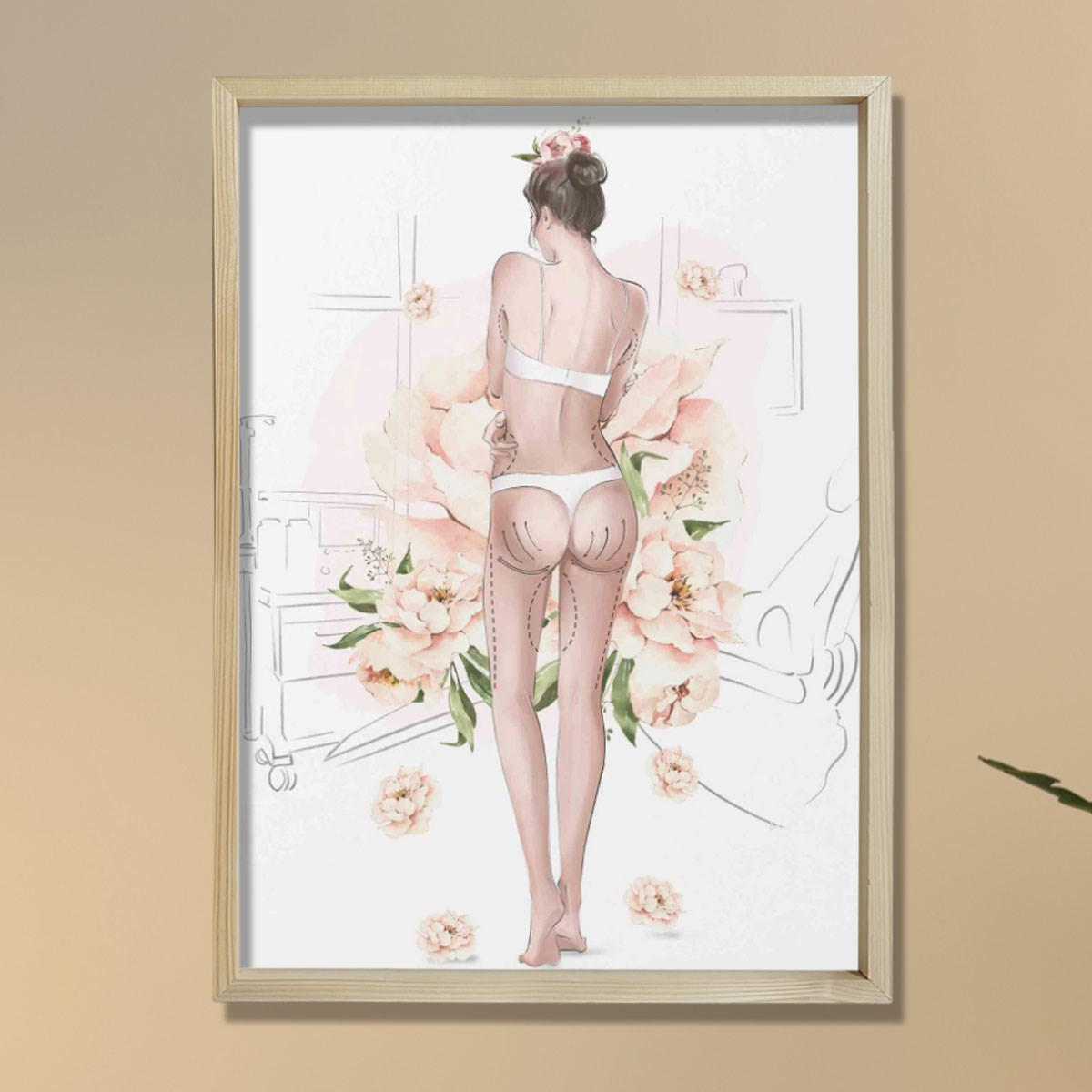 Plastik Cerrah Ameliyat İşaretleri,  Plastik ve Estetik Cerrahı, Doktor Odası Duvar Tablosu