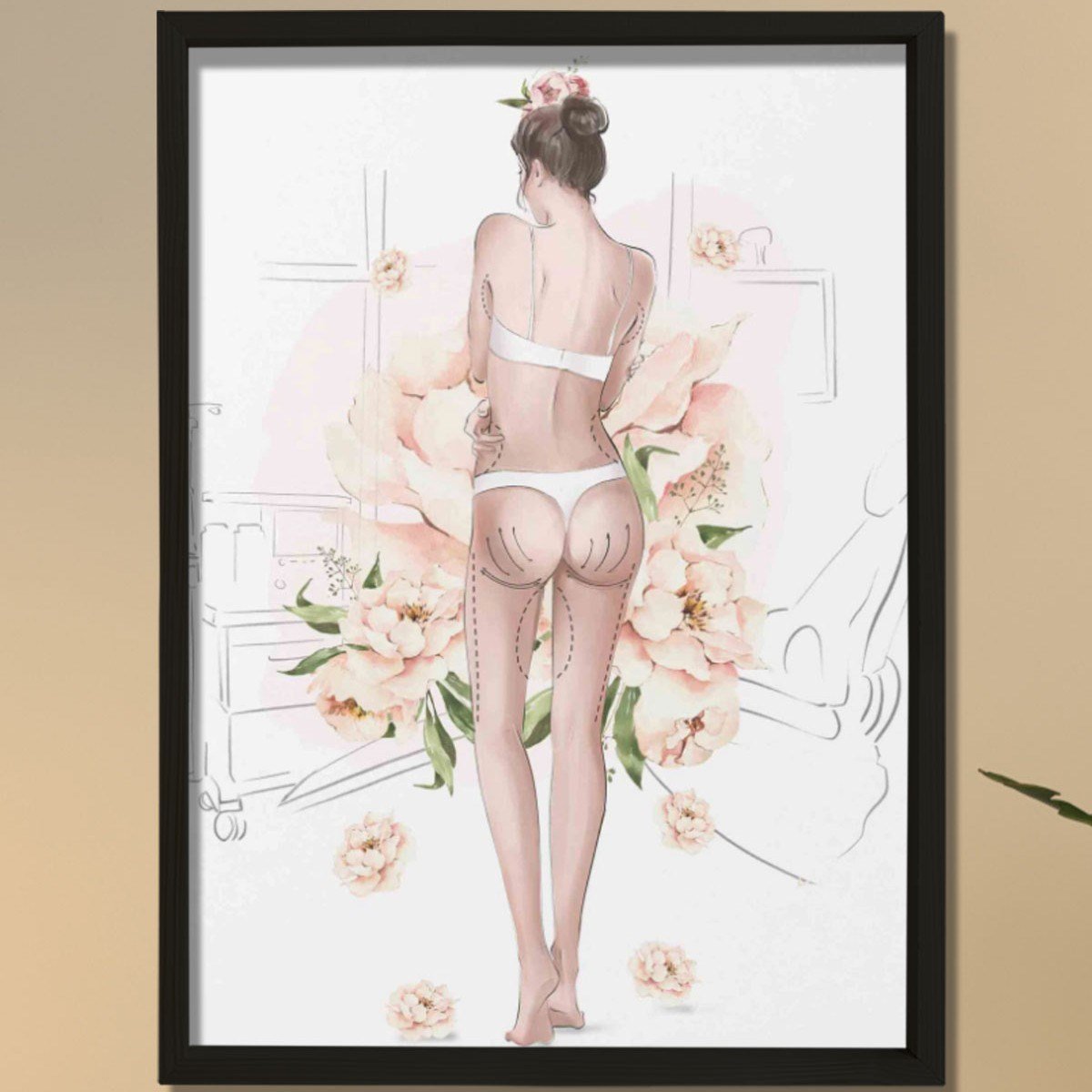 Plastik Cerrah Ameliyat İşaretleri,  Plastik ve Estetik Cerrahı, Doktor Odası Duvar Tablosu